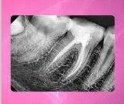 Dentist performing MDS Dental X-ray at AR 32 Wadgaon Sheri