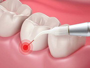 Dentist performing MDS Periodontist at AR 32 Wadgaon Sheri