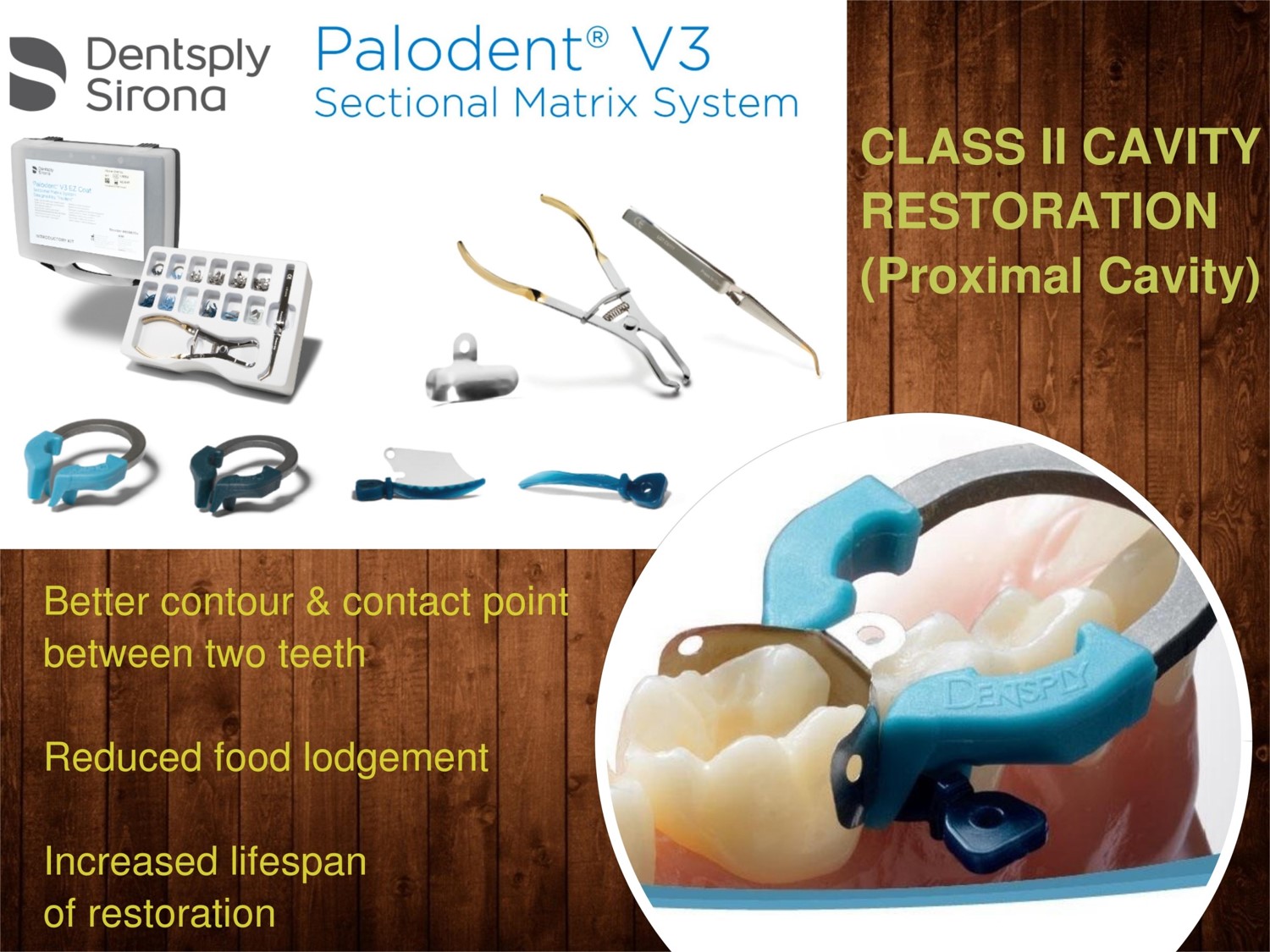 Interdental Matrices