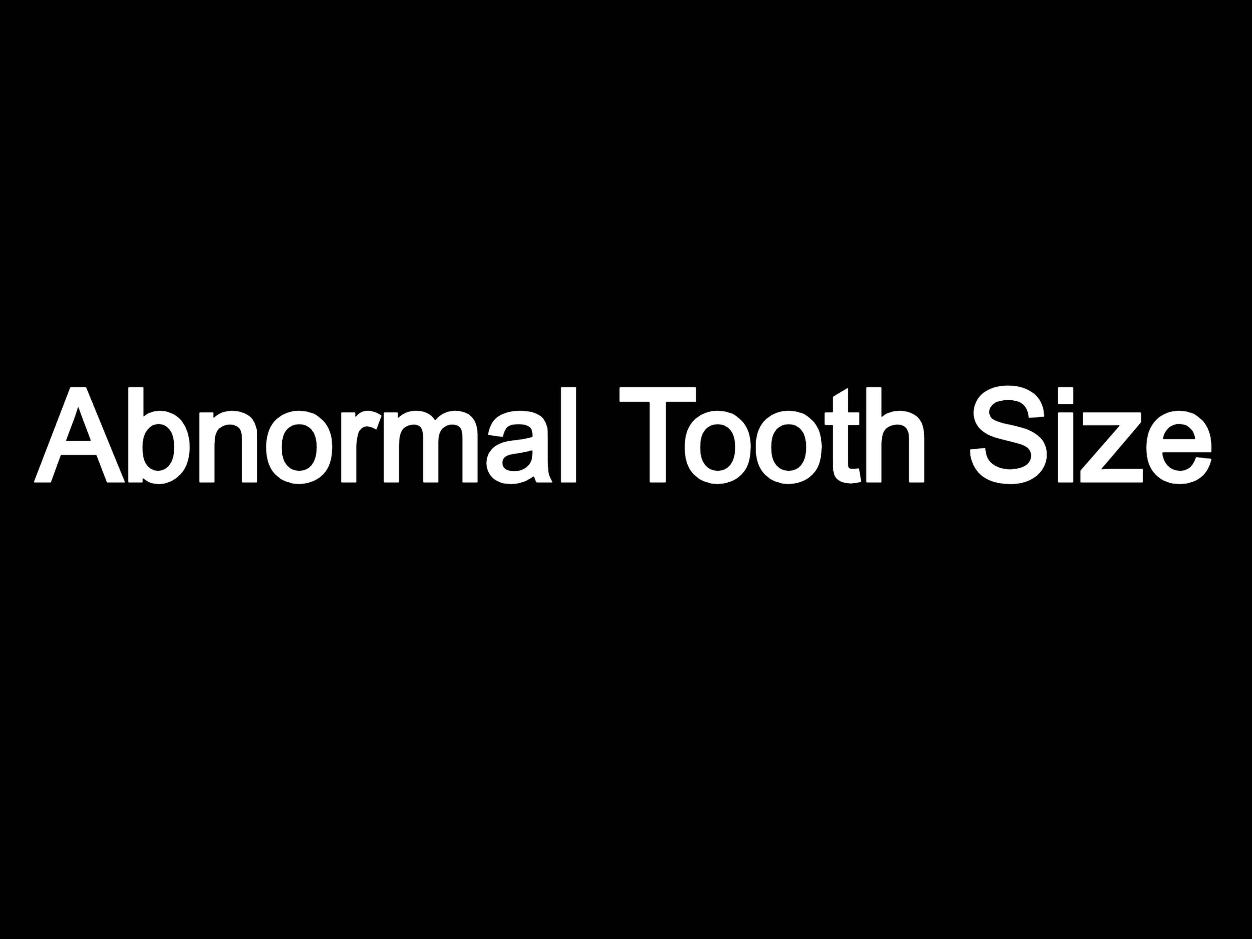 Abnormal tooth Size - Macrodontia / Microdontia