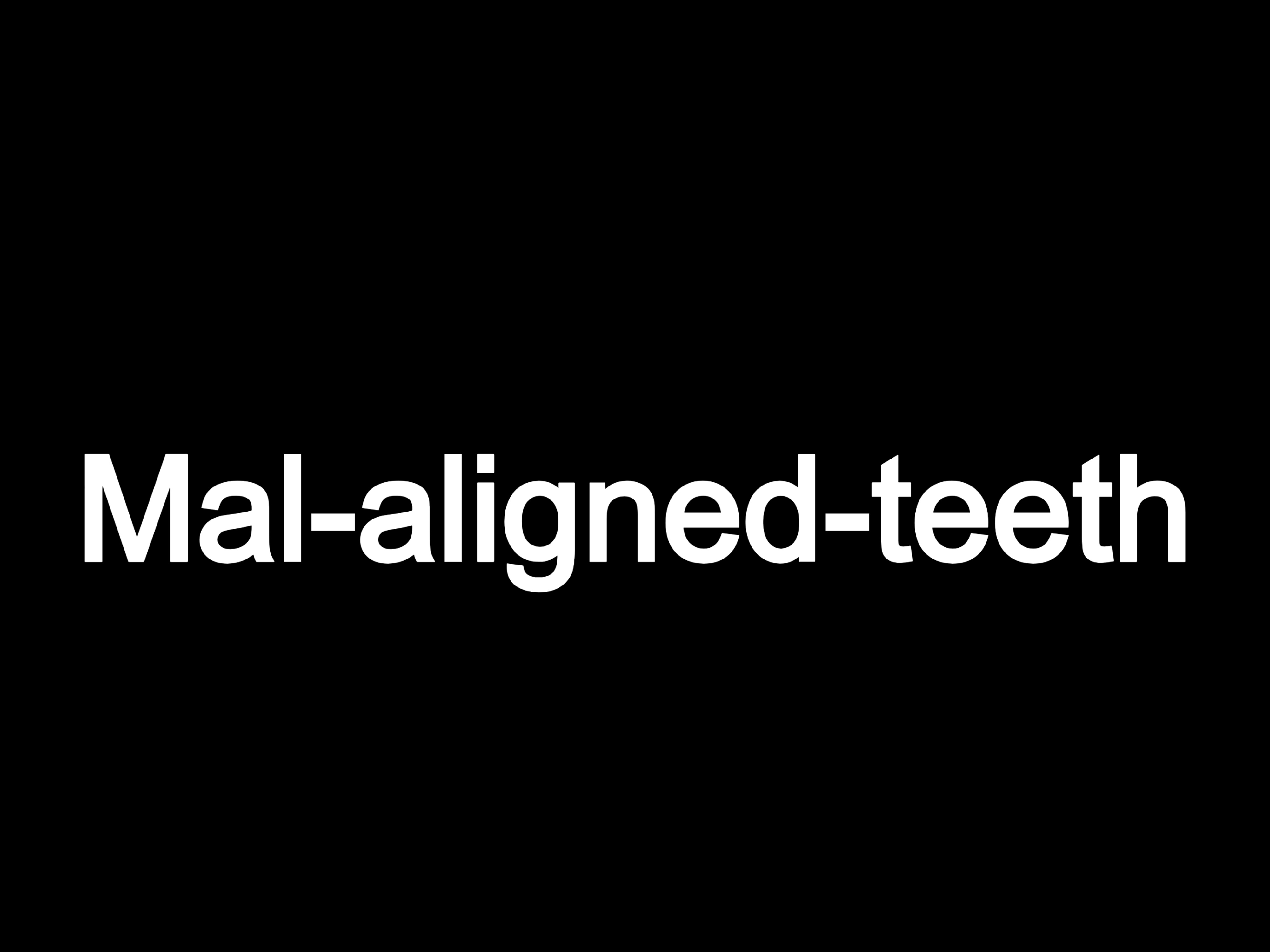 Mal-aligned teeth or croocked teeth
