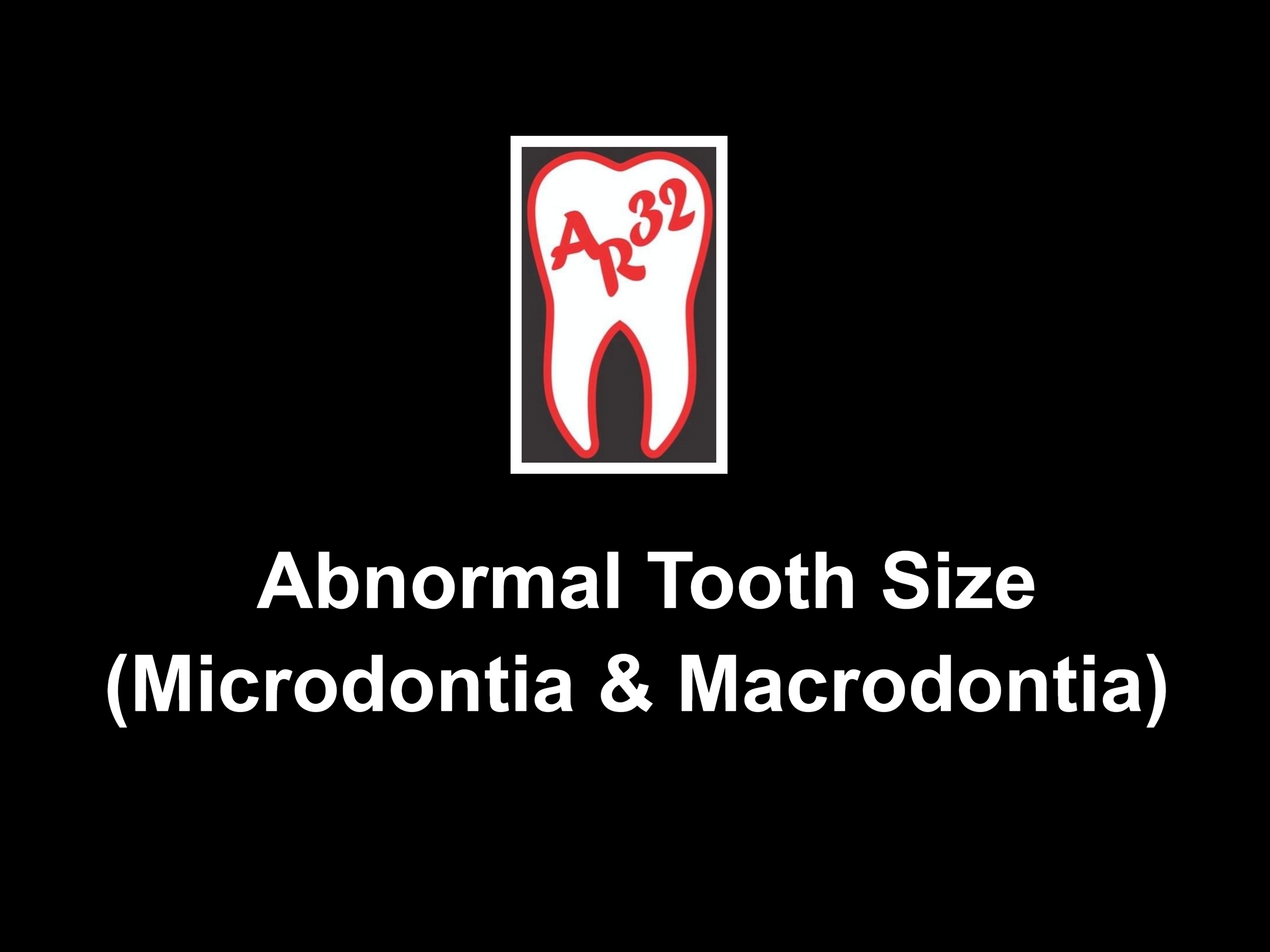 Abnormal tooth size microdontia macrodontia peg laterals clinical representation