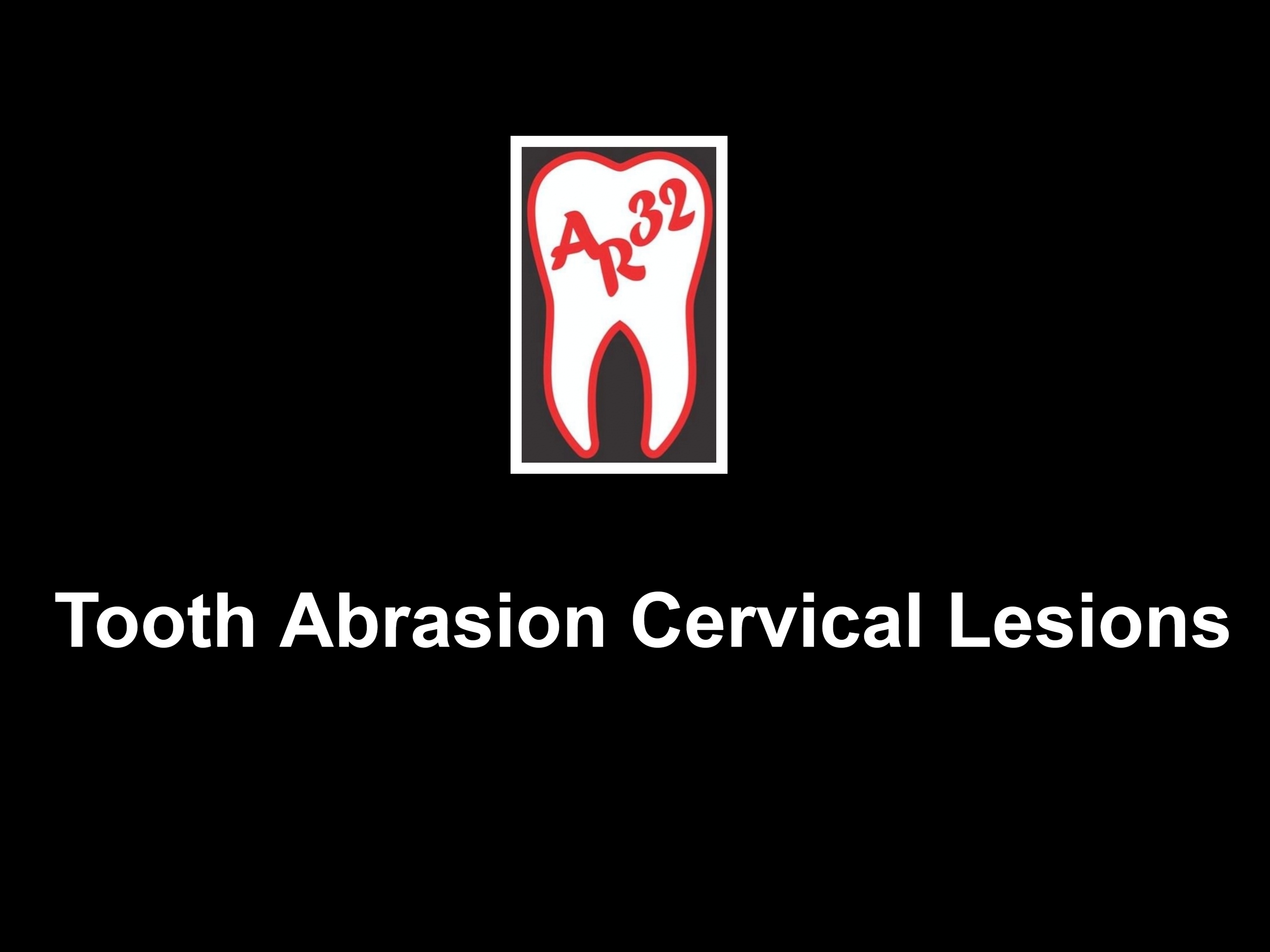 Tooth abrasion V-shaped notches cervical lesions clinical representation