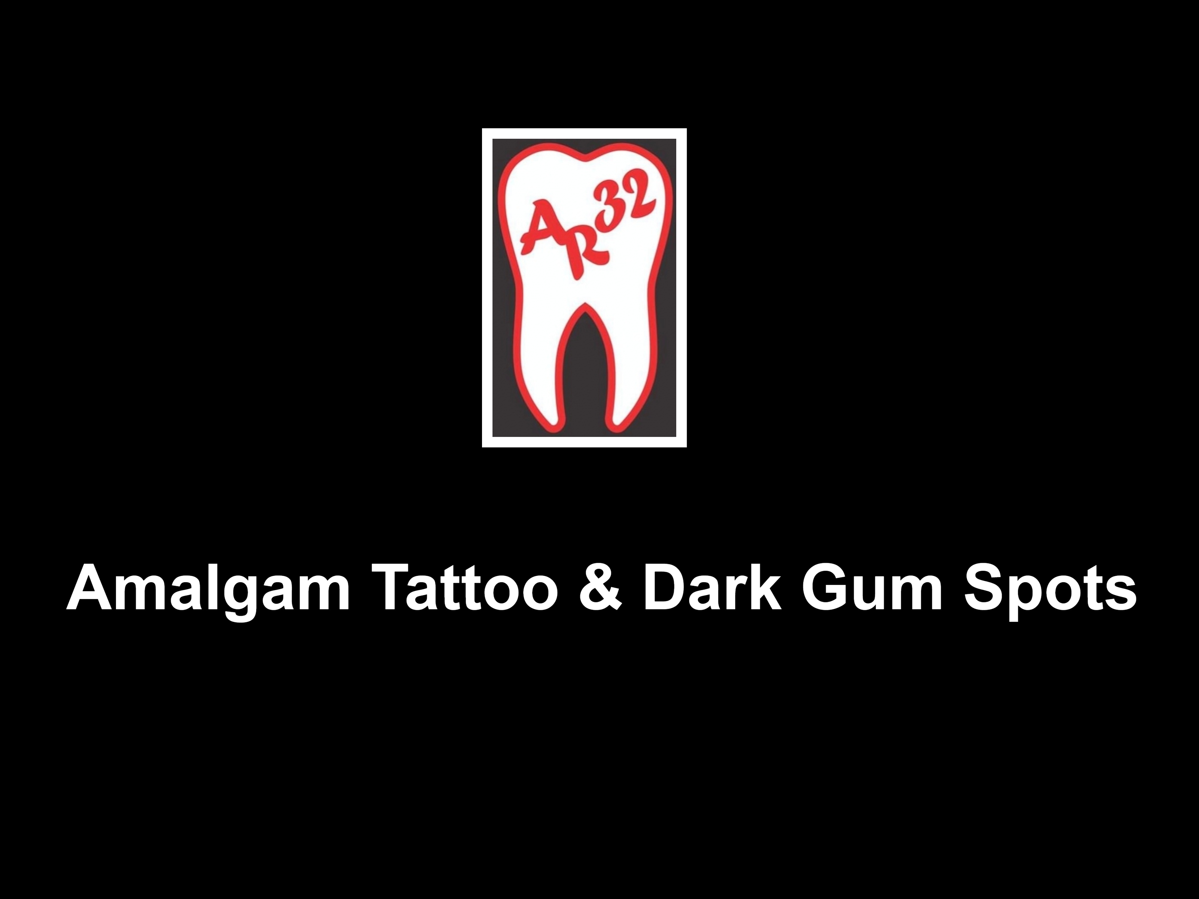 Amalgam tattoo blue black spot on gums clinical representation