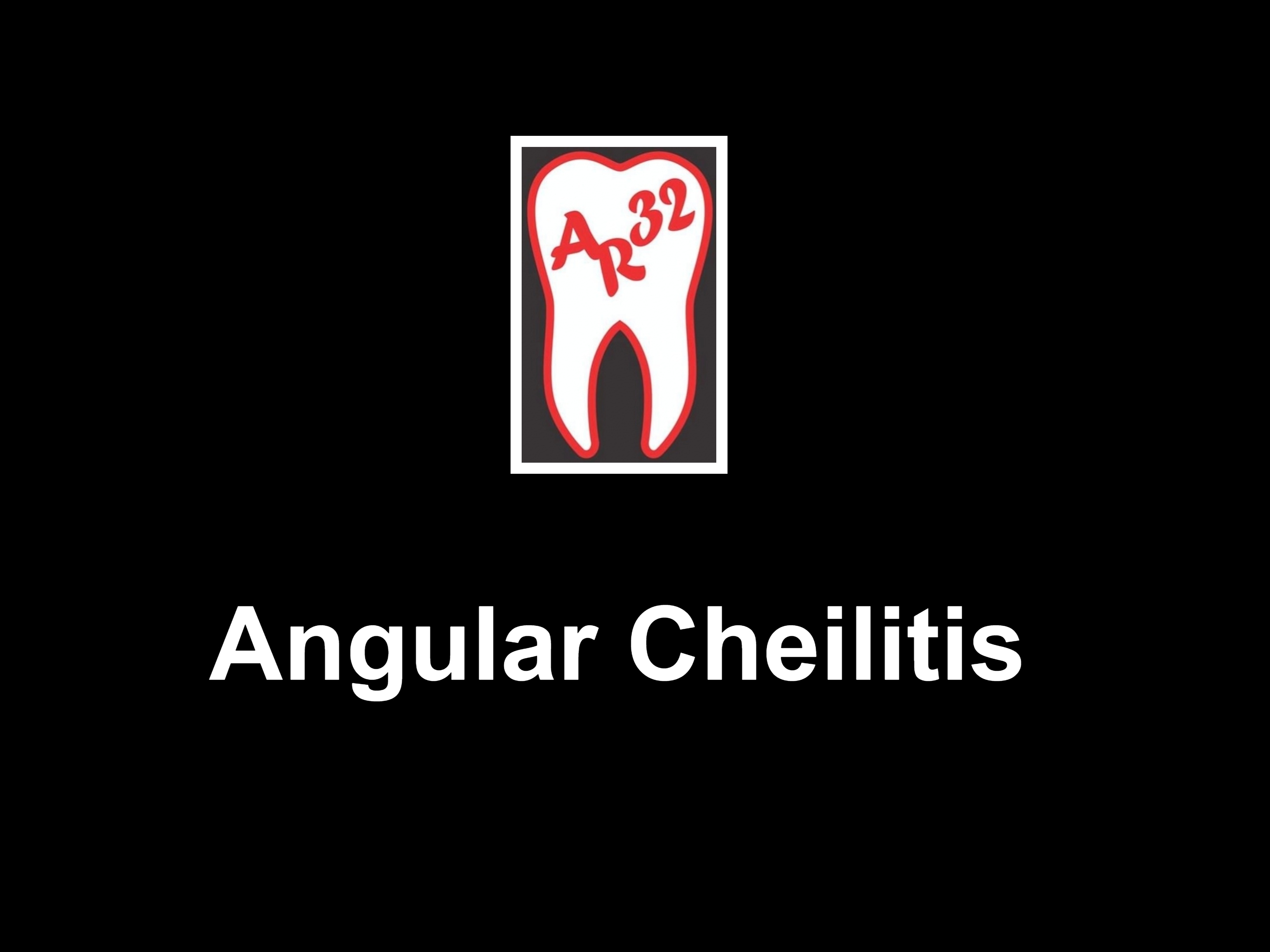 Angular cheilitis cracked corners of mouth lips clinical representation
