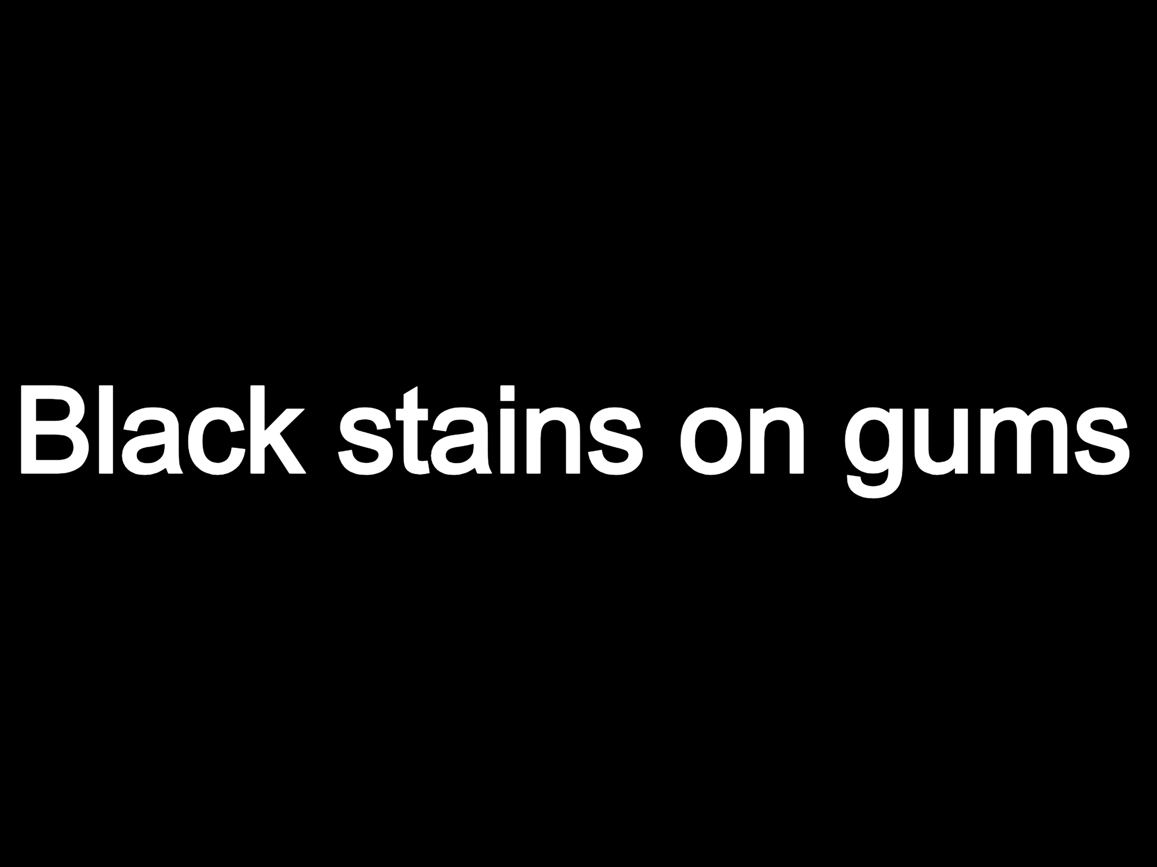 Black stains on gums