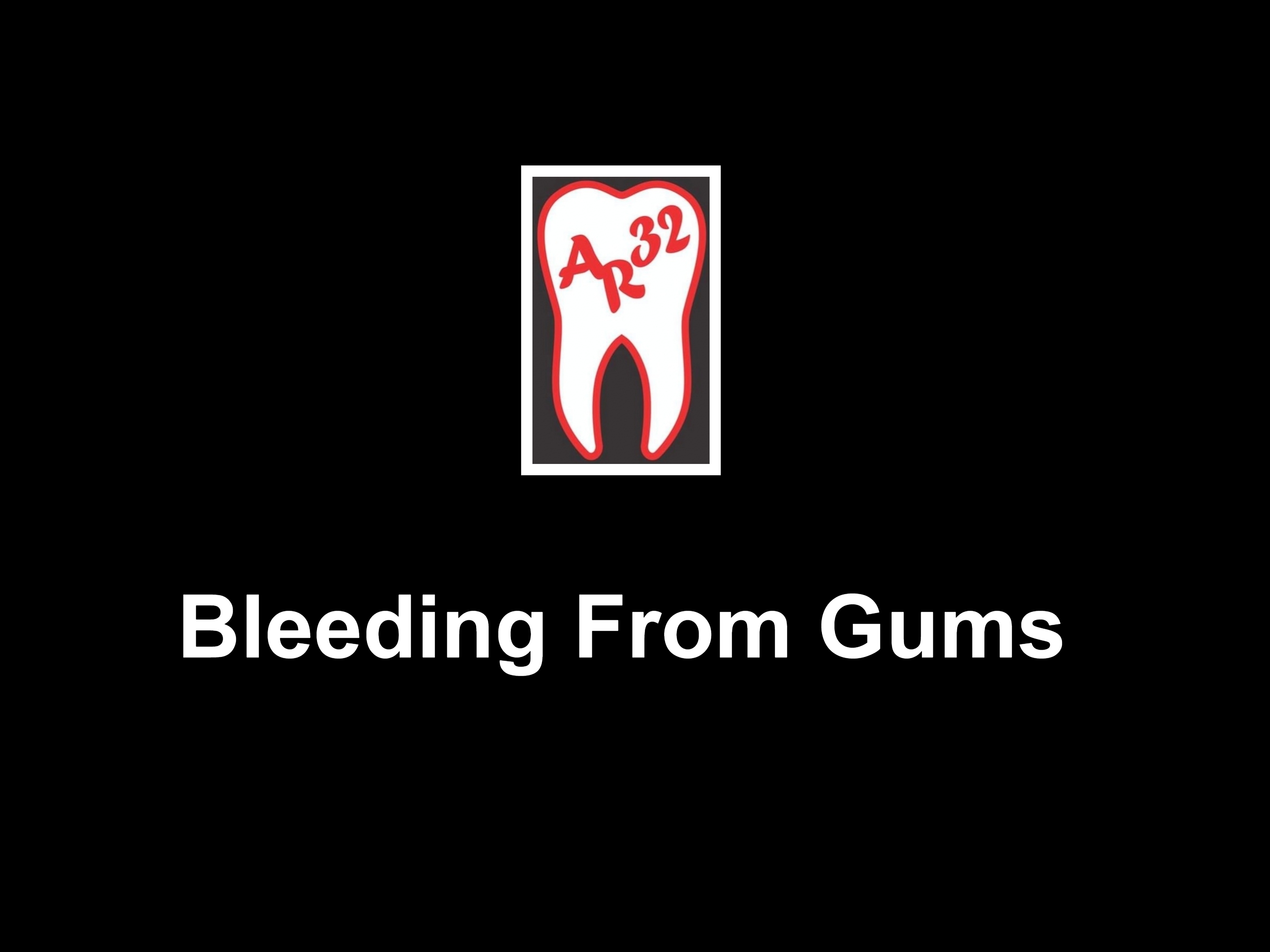 Bleeding gums gingivitis periodontal disease clinical representation