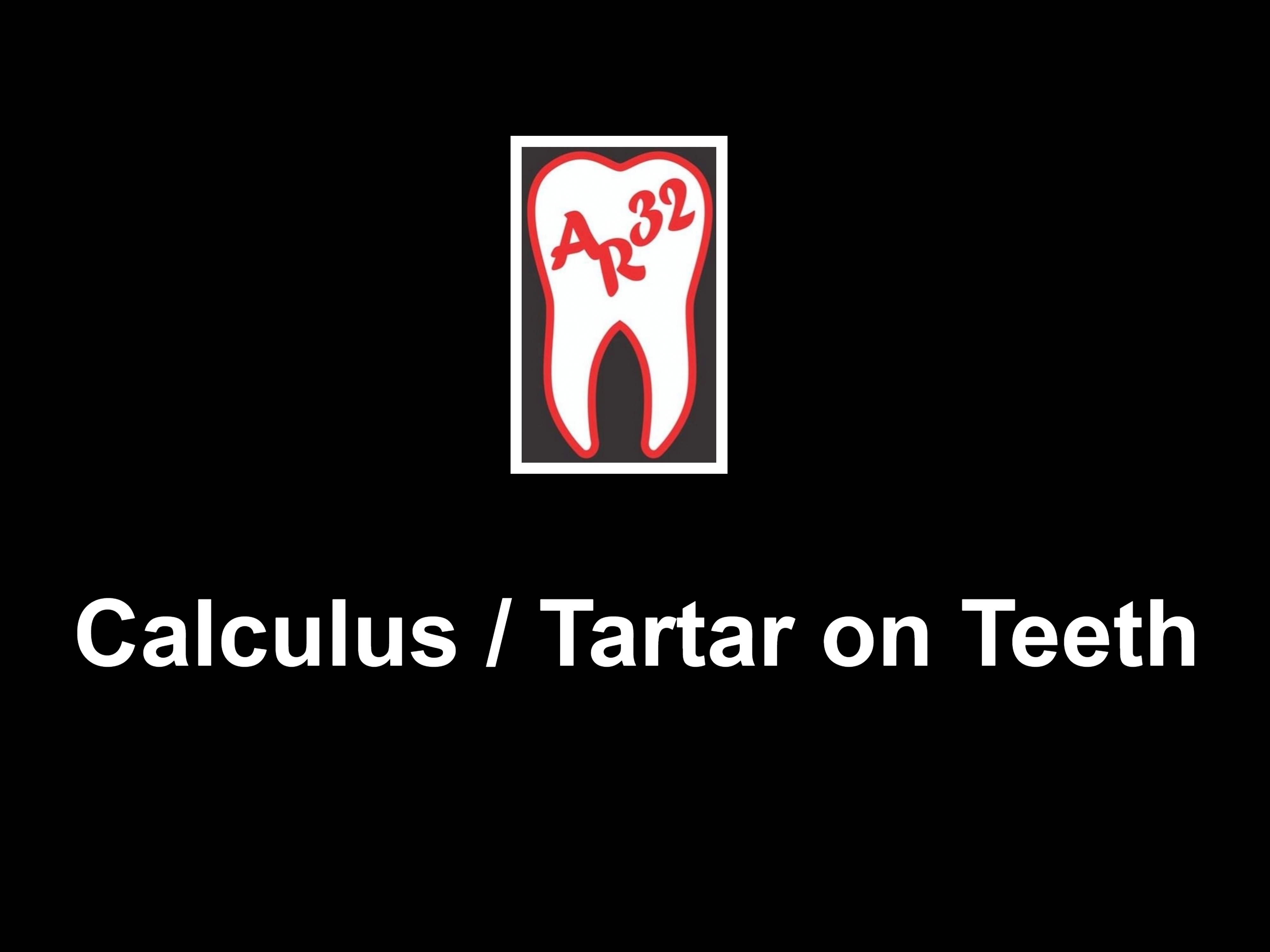 Calculus tartar on teeth hard plaque gum disease clinical representation