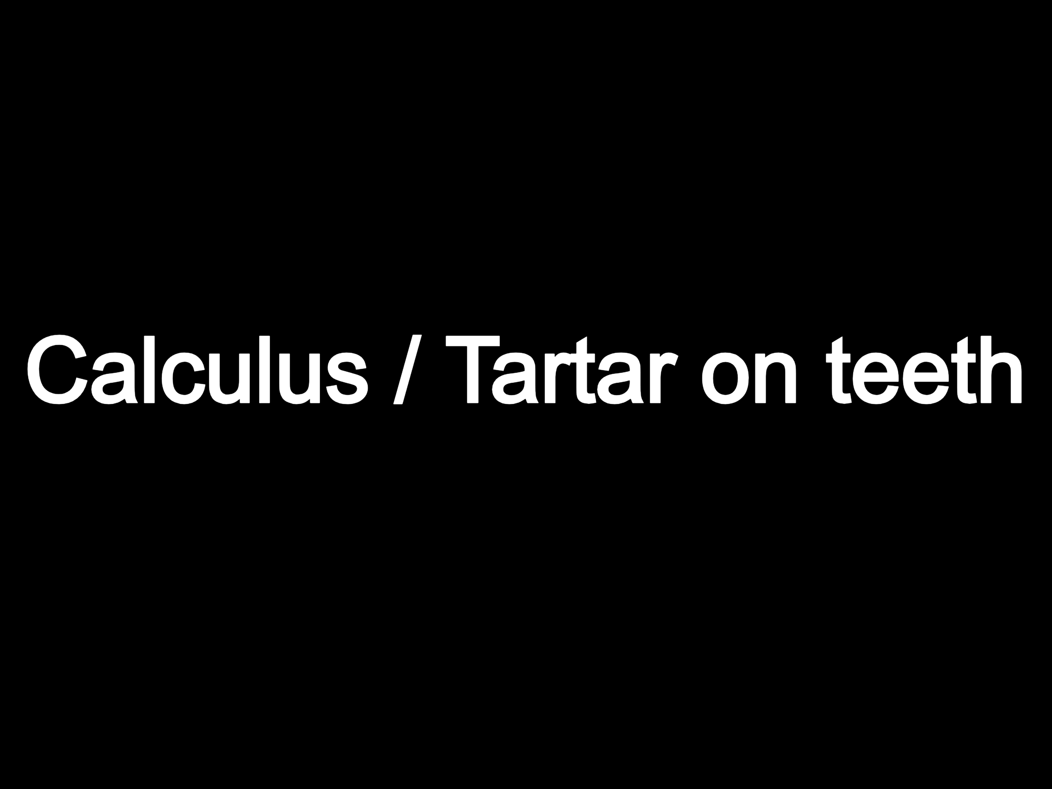 Calculus / Tartar on teeth