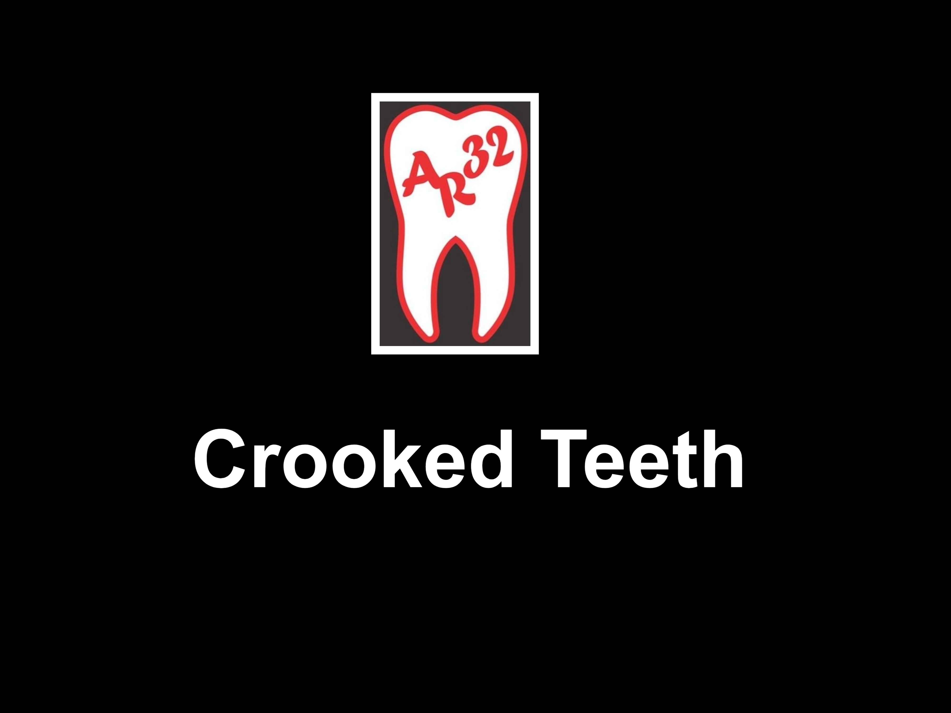 Crooked teeth misaligned smile clear aligners clinical representation