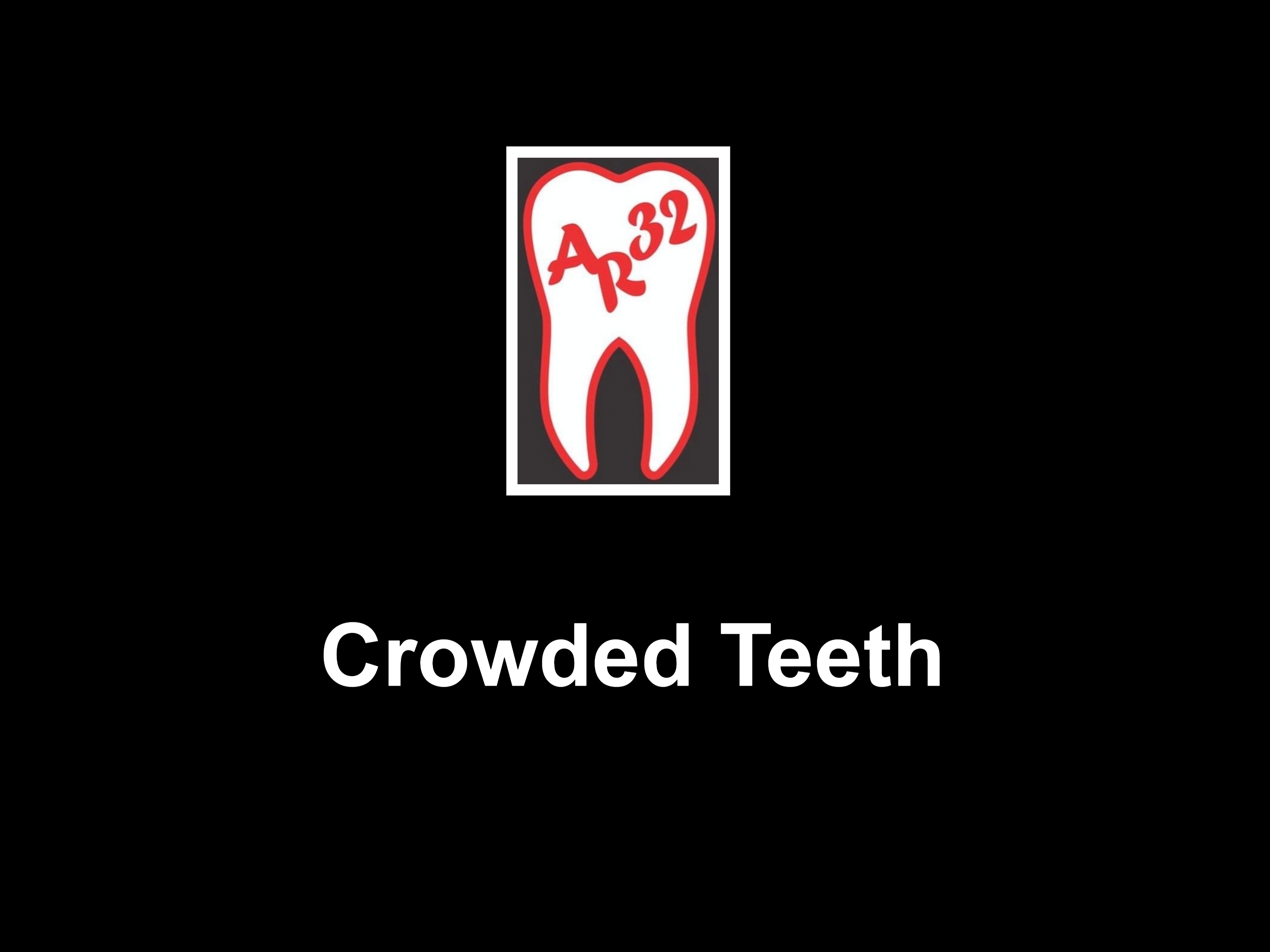 Crowded teeth overlapping arch expansion clinical representation
