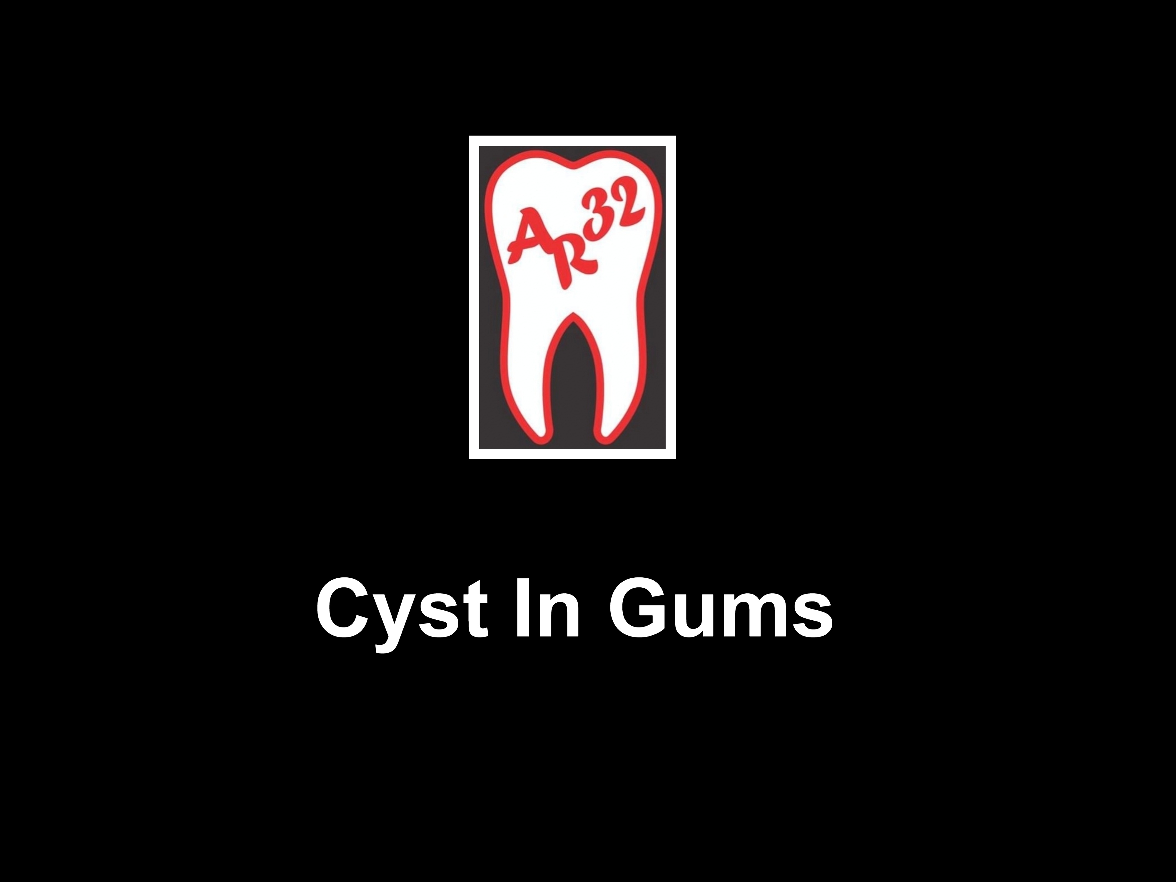 Cyst in gums apical radicular cyst CBCT scan jawbone clinical representation