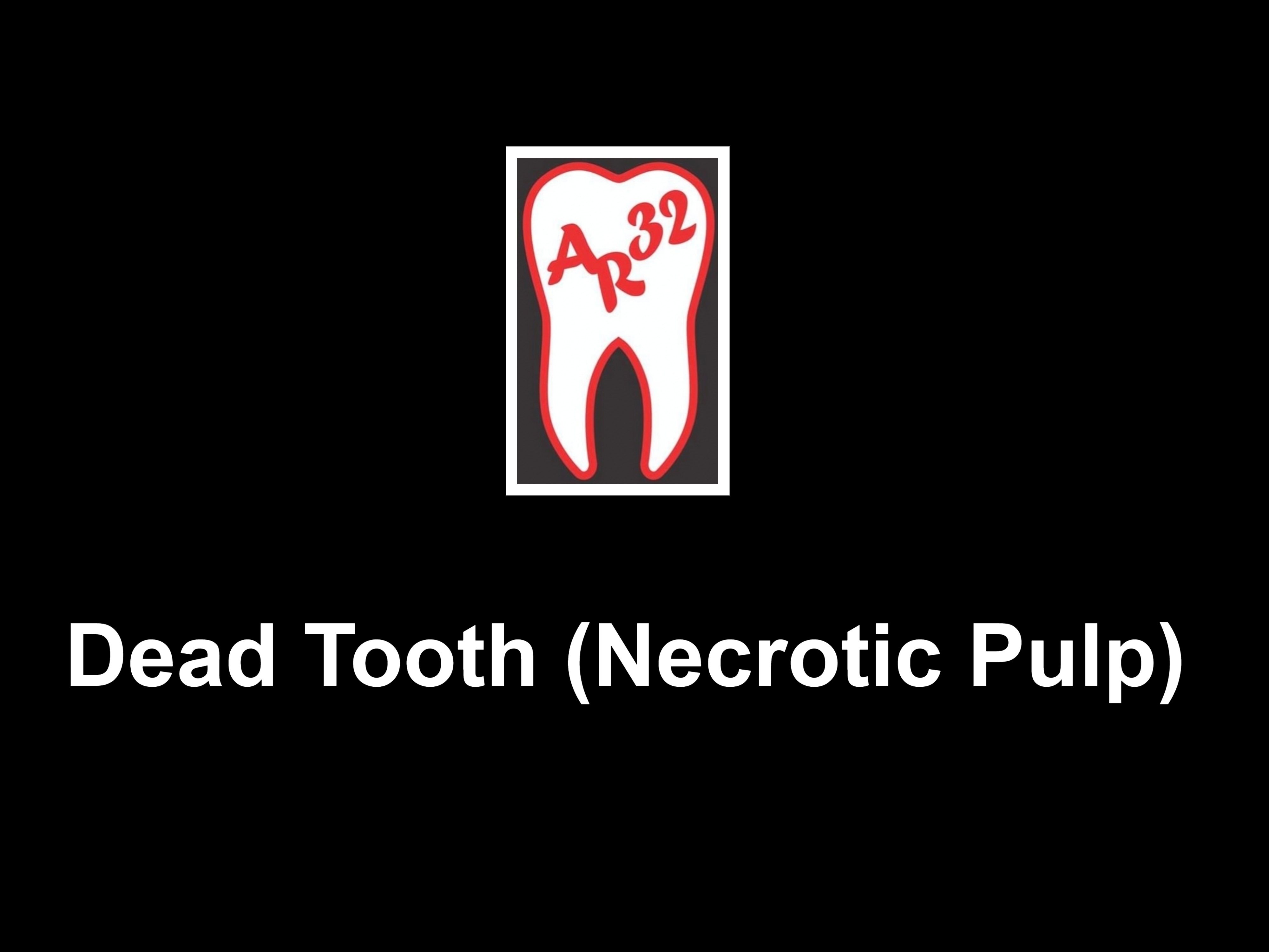 Dead tooth dark discolored necrotic pulp root canal clinical representation