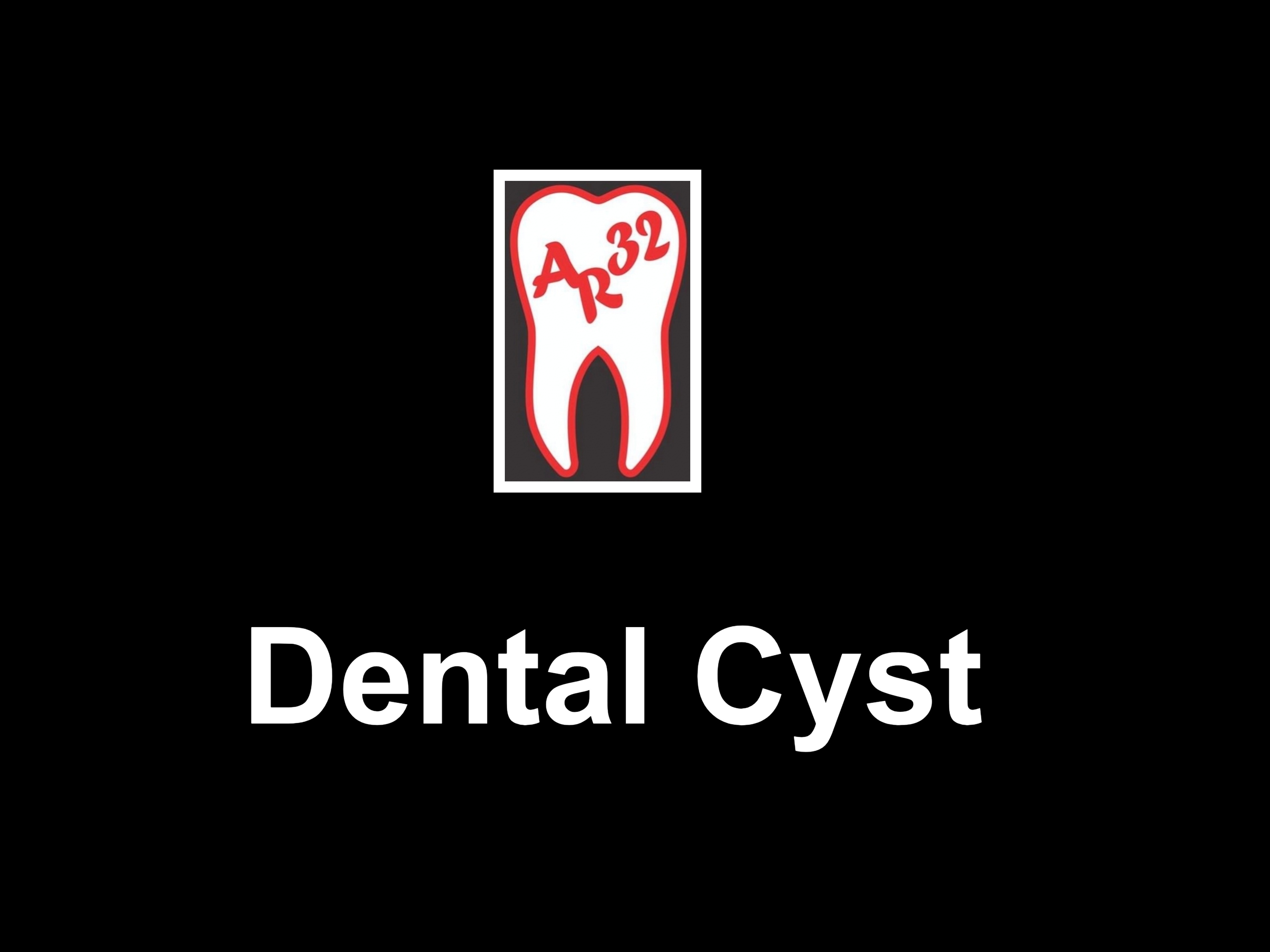 Dental cyst jawbone swelling clinical radiograph representation