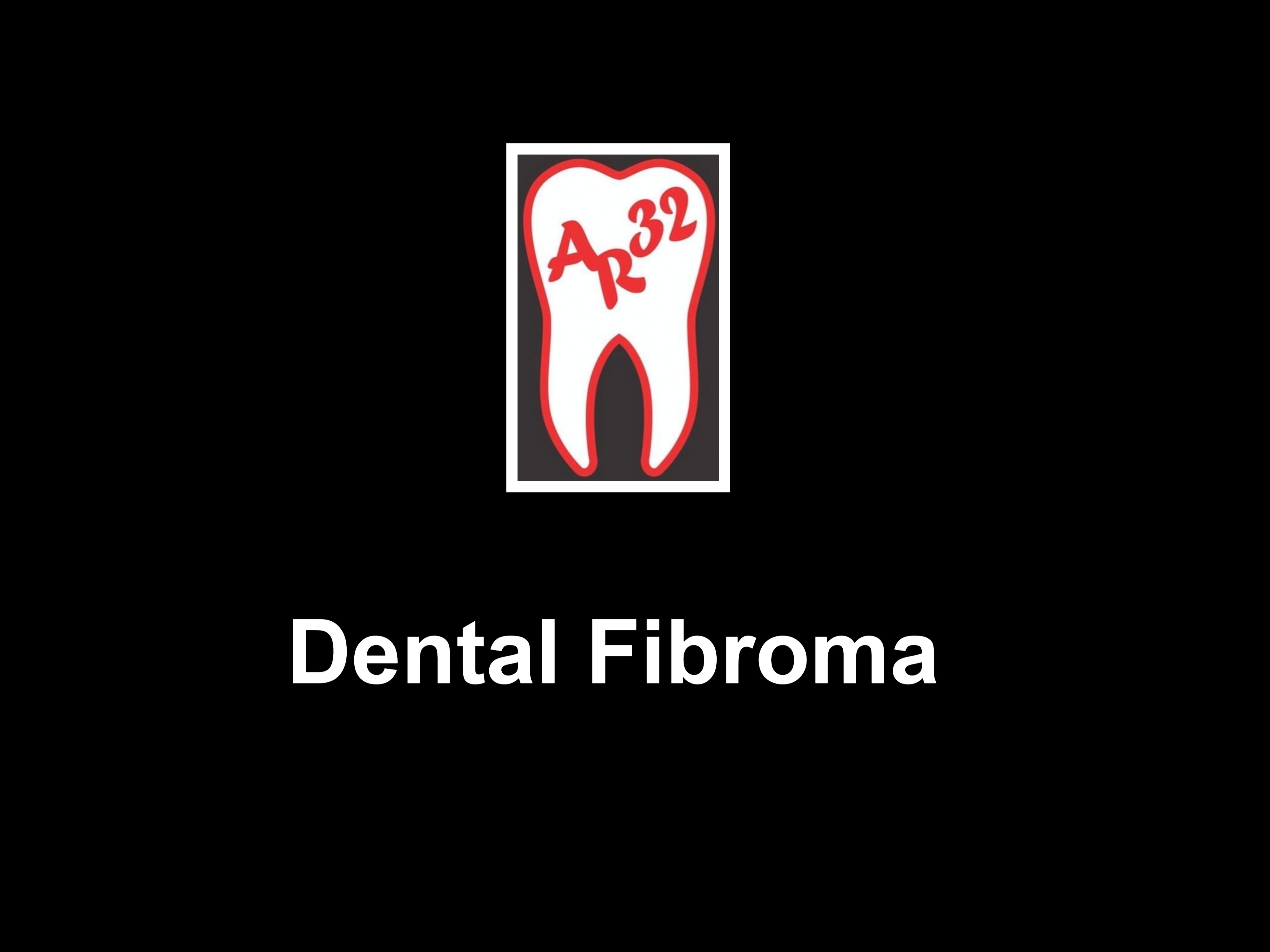 Dental fibroma bump inside cheek benign oral tumor clinical representation