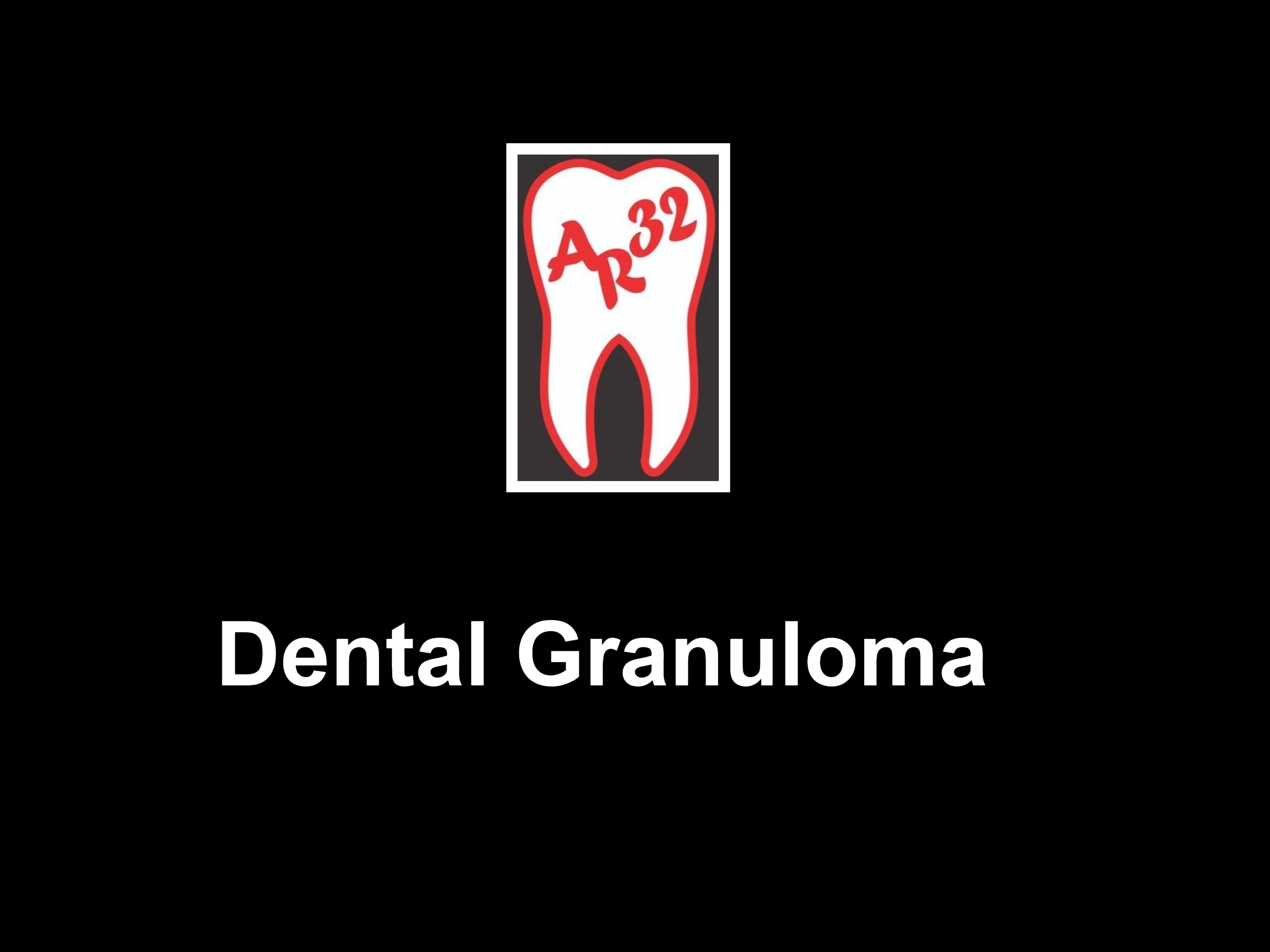 Dental granuloma apical pathology tooth root shadow clinical representation