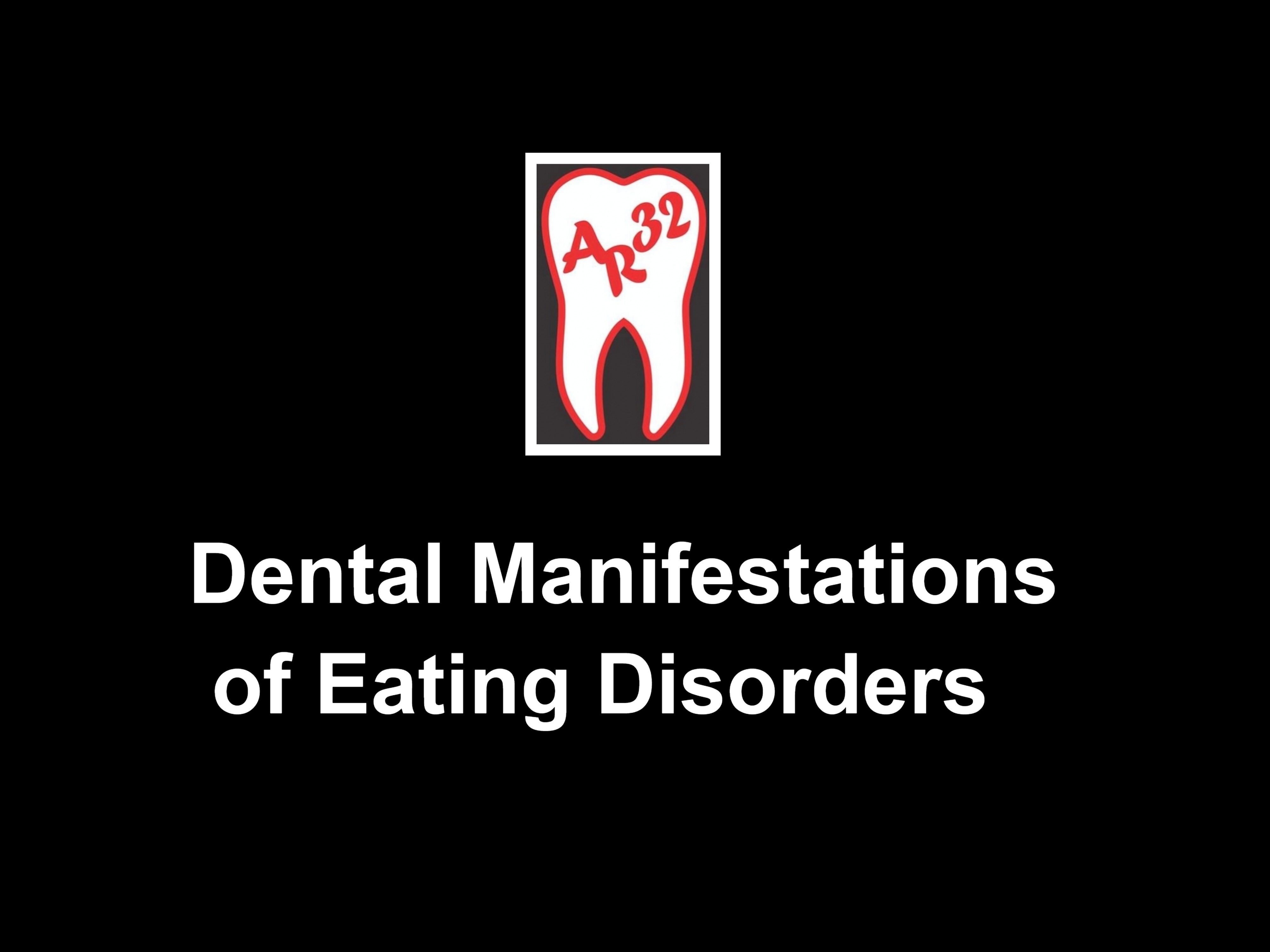 Tooth erosion and damage from eating disorders clinical representation