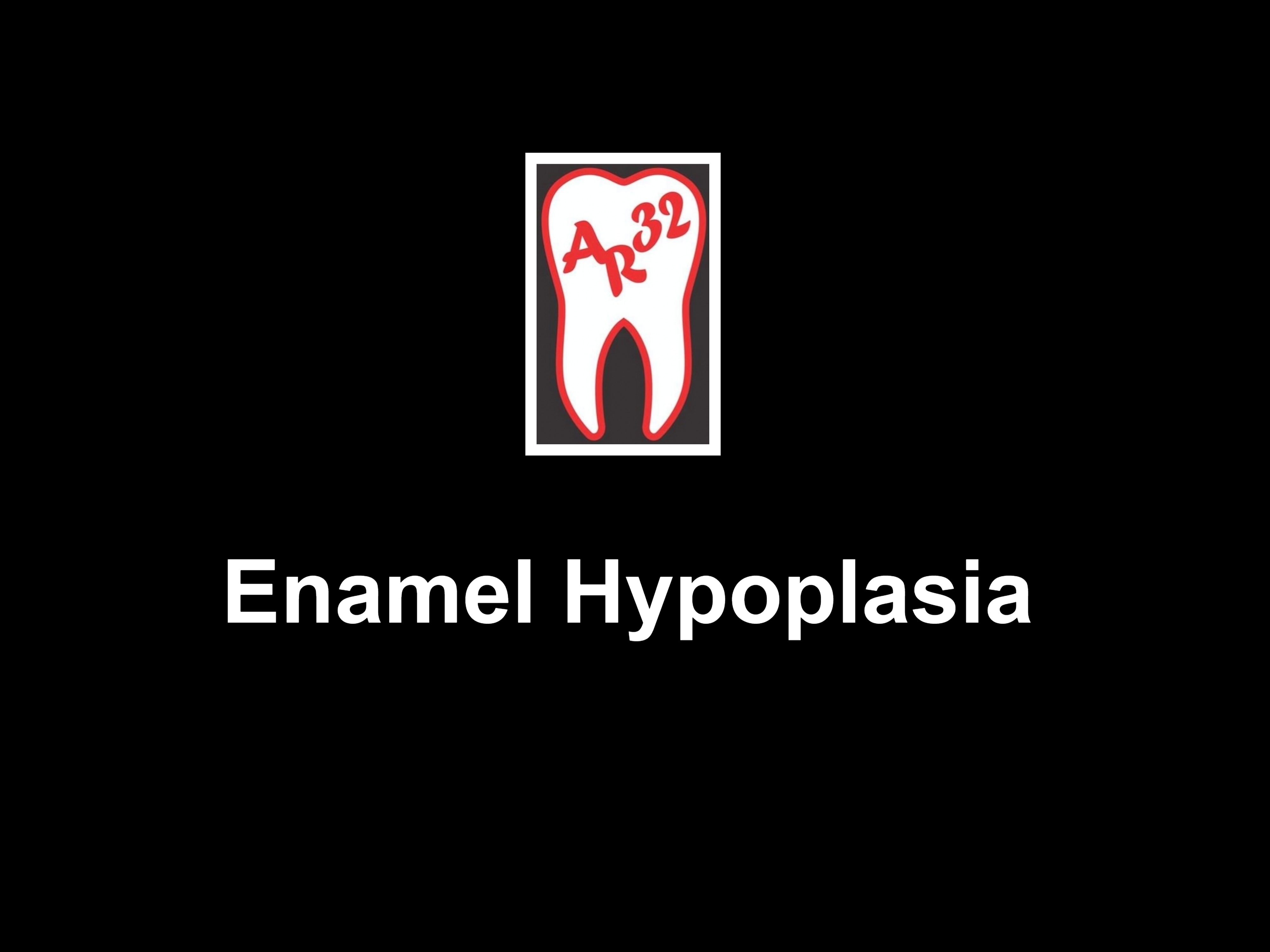 Enamel hypoplasia and weak teeth clinical representation