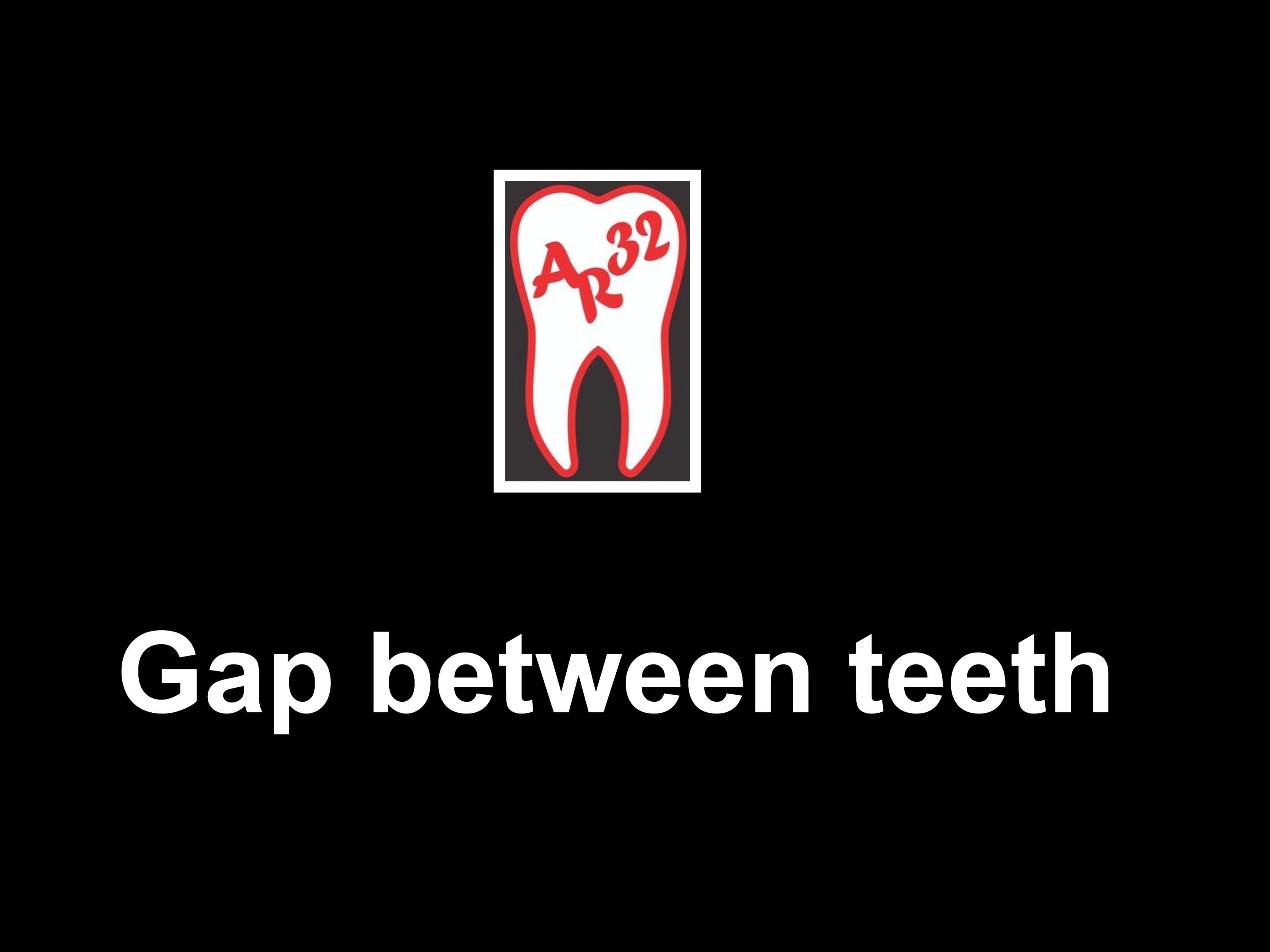Gap between front teeth diastema clinical representation
