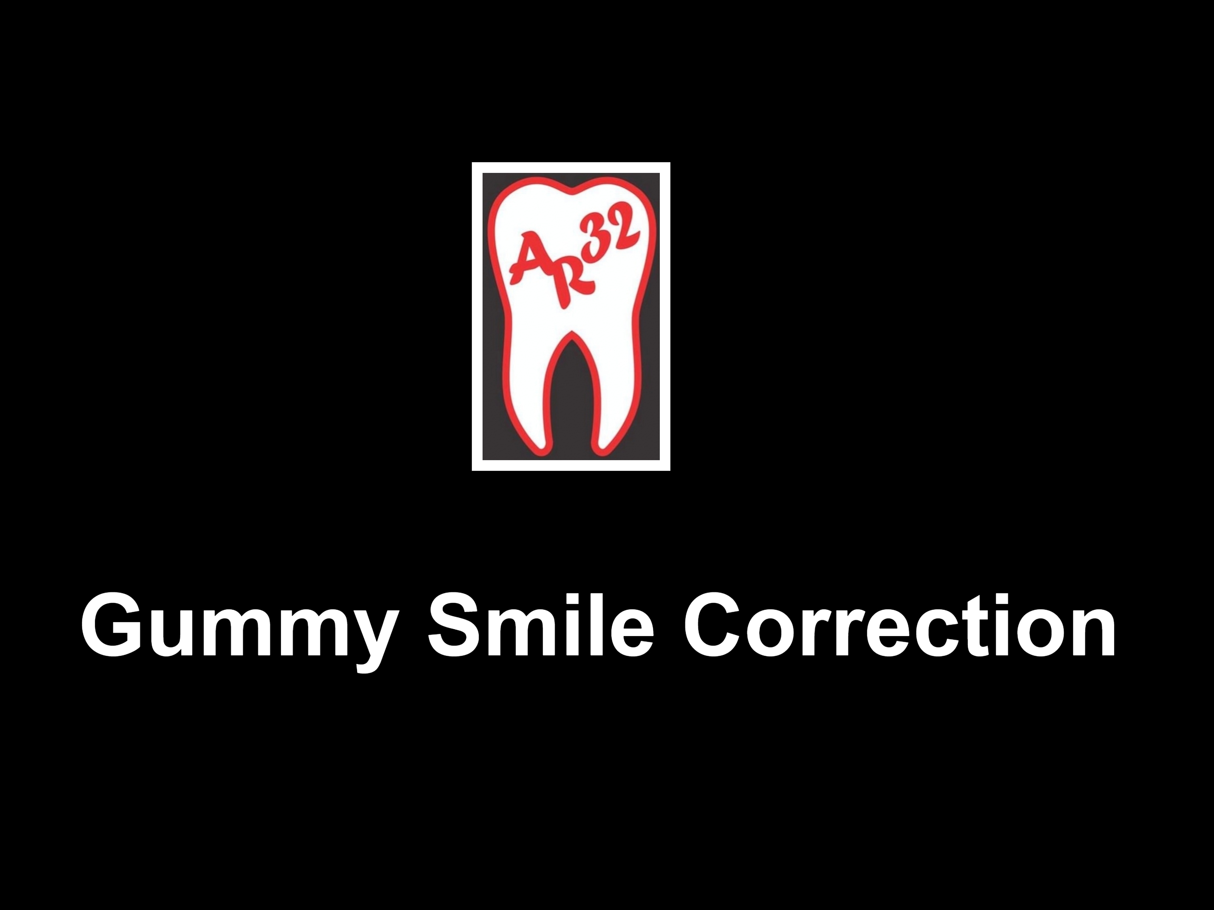 Gummy smile excessive gingival display clinical representation