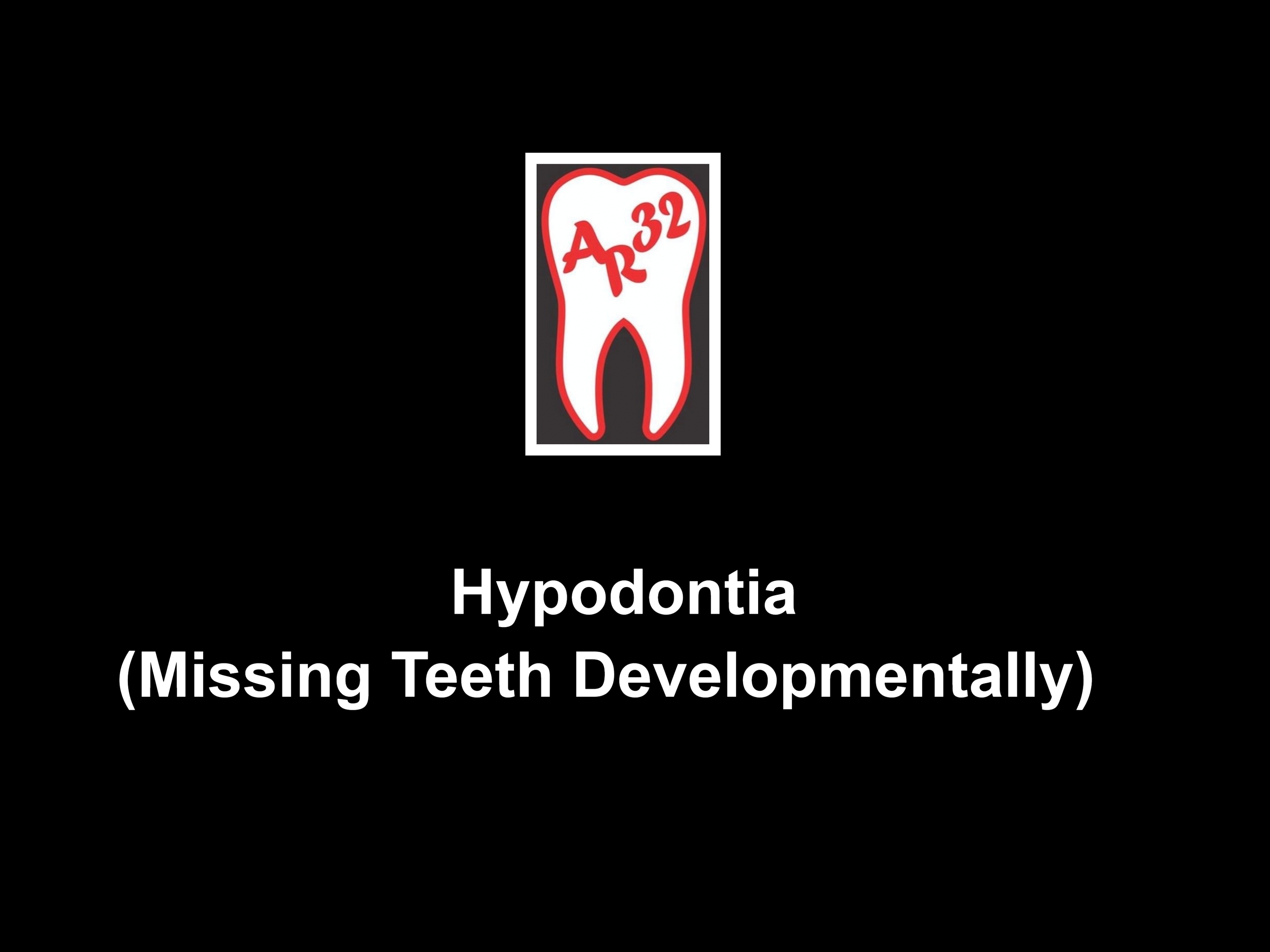 Hypodontia and congenitally missing teeth clinical representation