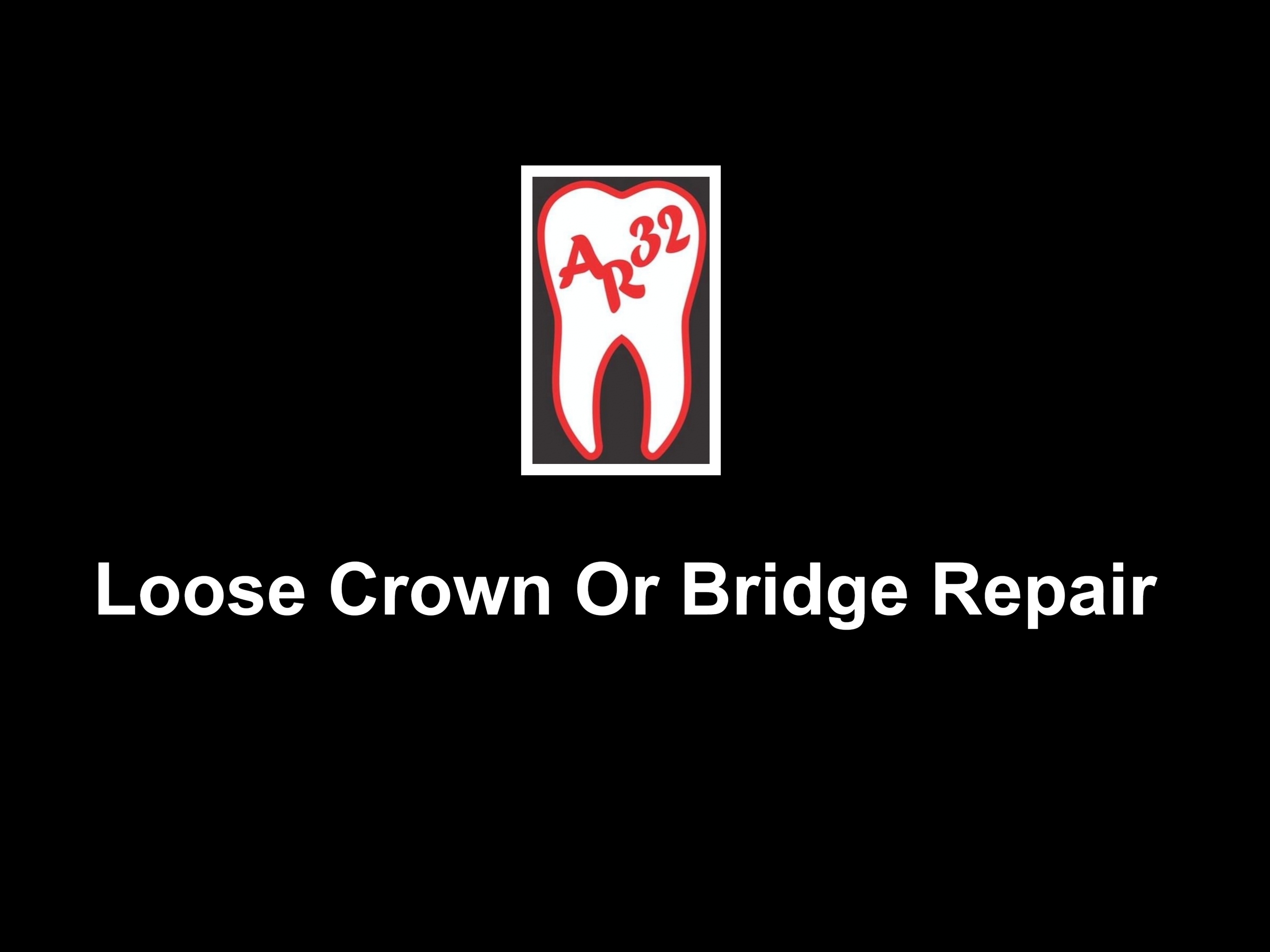 Loose dental crown and bridge prosthesis clinical representation