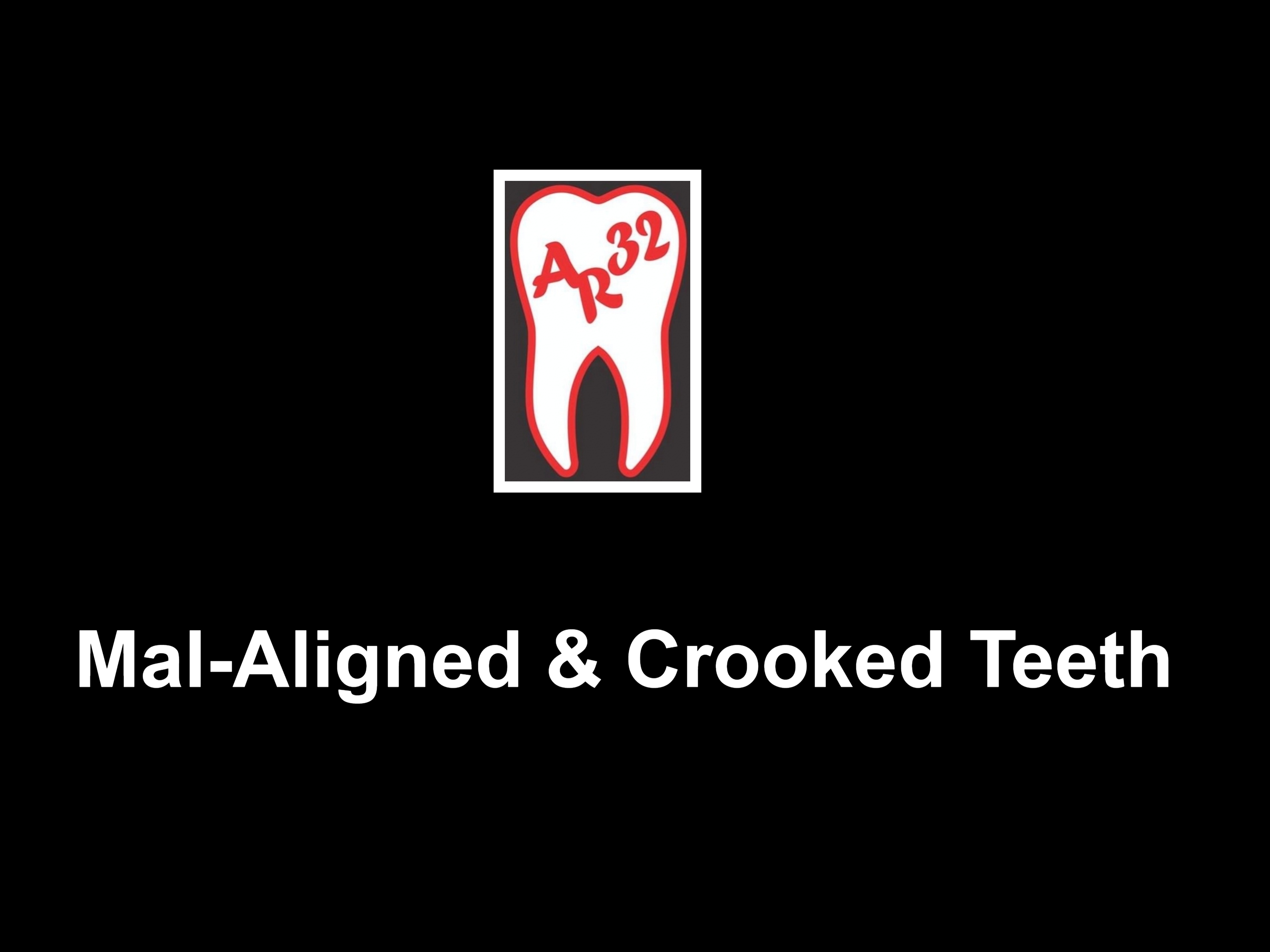 Mal-aligned crooked and crowded teeth clinical representation