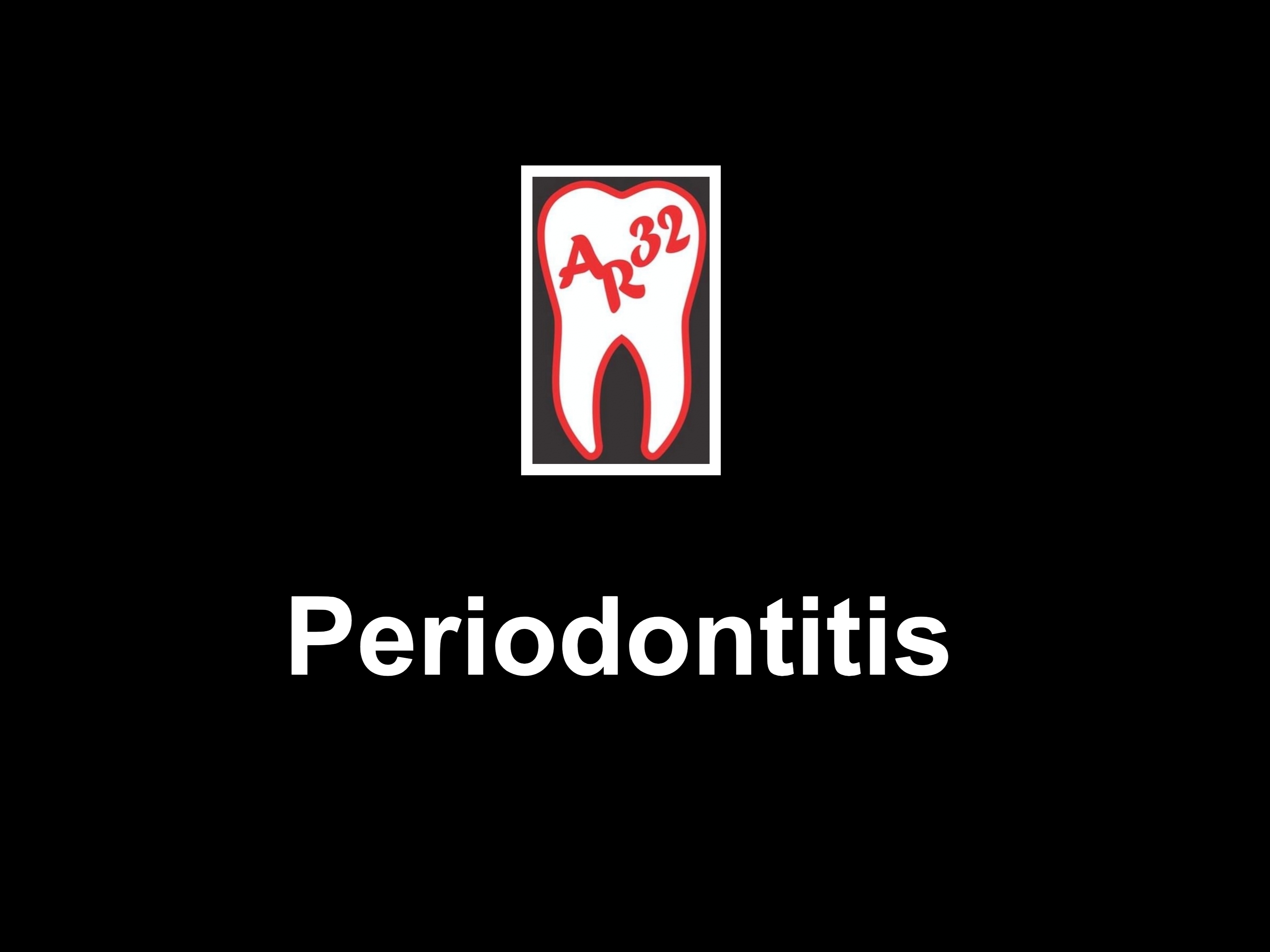 Periodontitis advanced gum disease and bone loss clinical representation