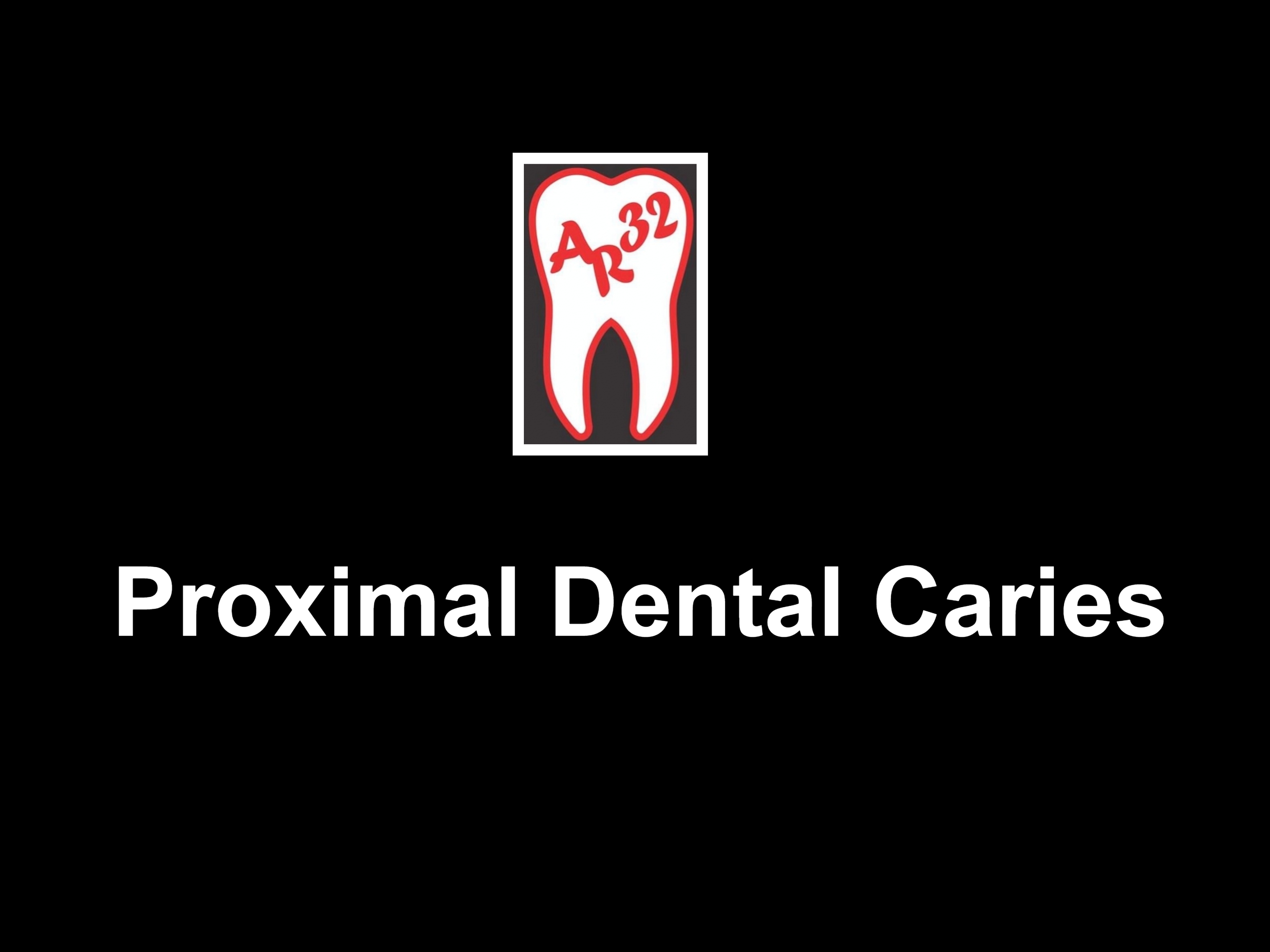 Proximal dental caries (cavities between teeth) clinical representation