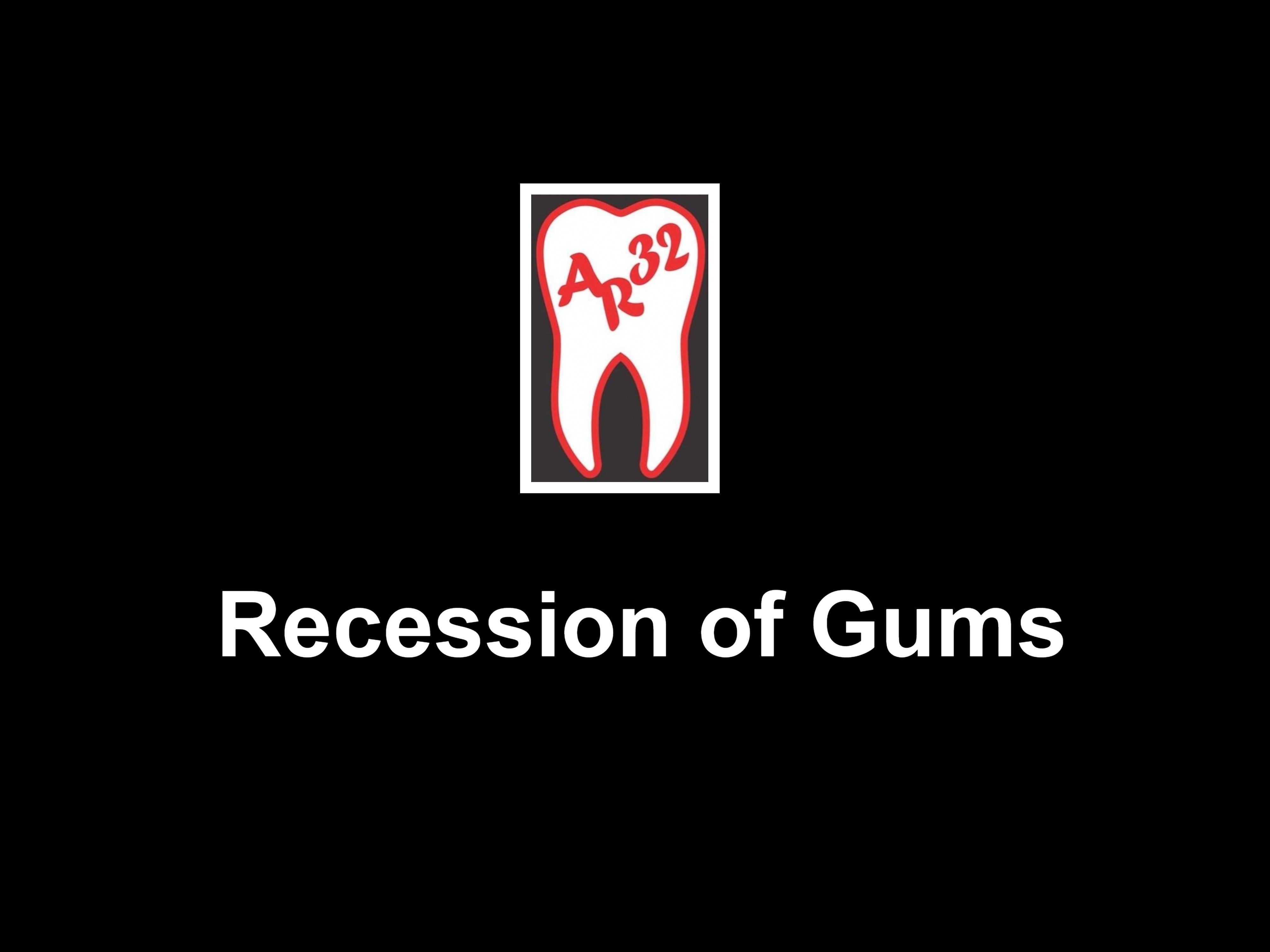 Recession of gums and clinical root exposure representation