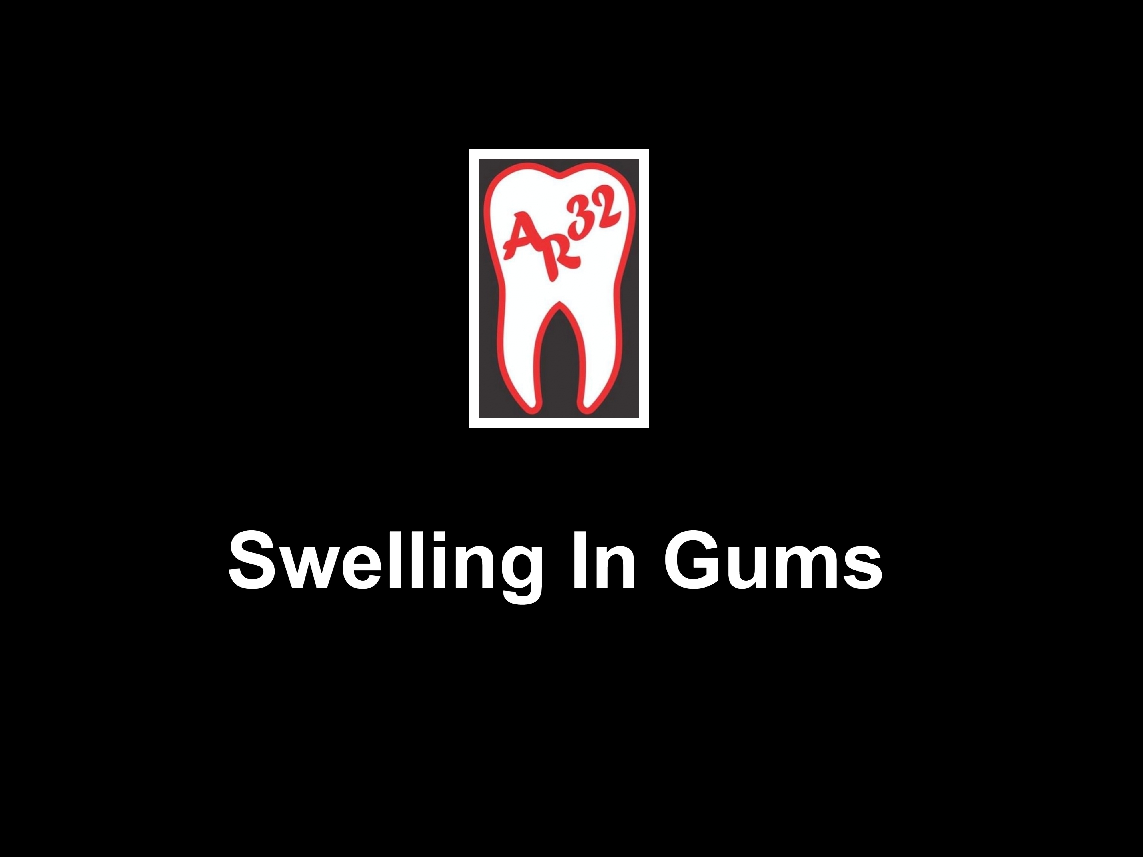 Swollen gums and gingival enlargement clinical representation