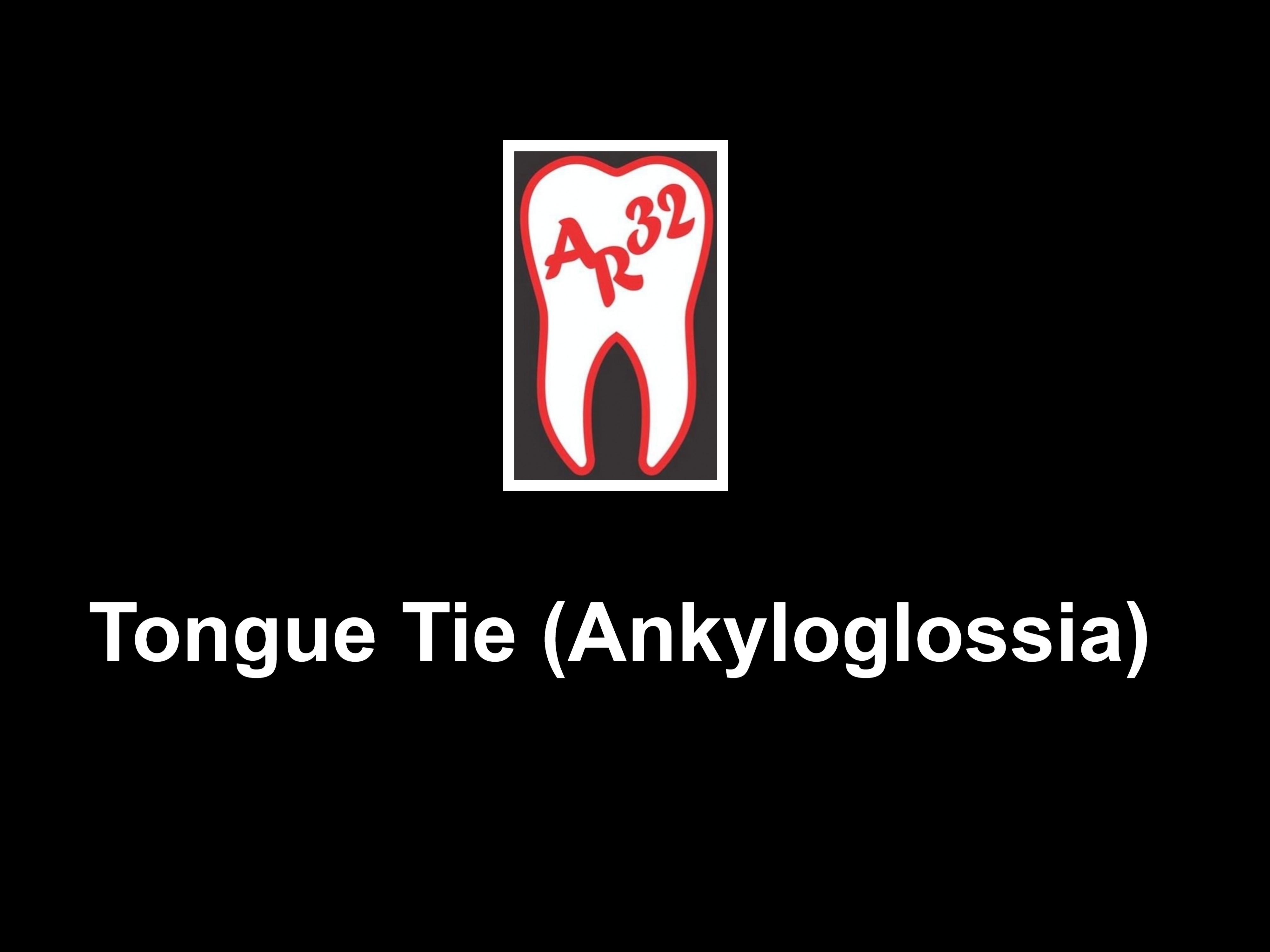 Tongue tie ankyloglossia lingual frenulum clinical representation