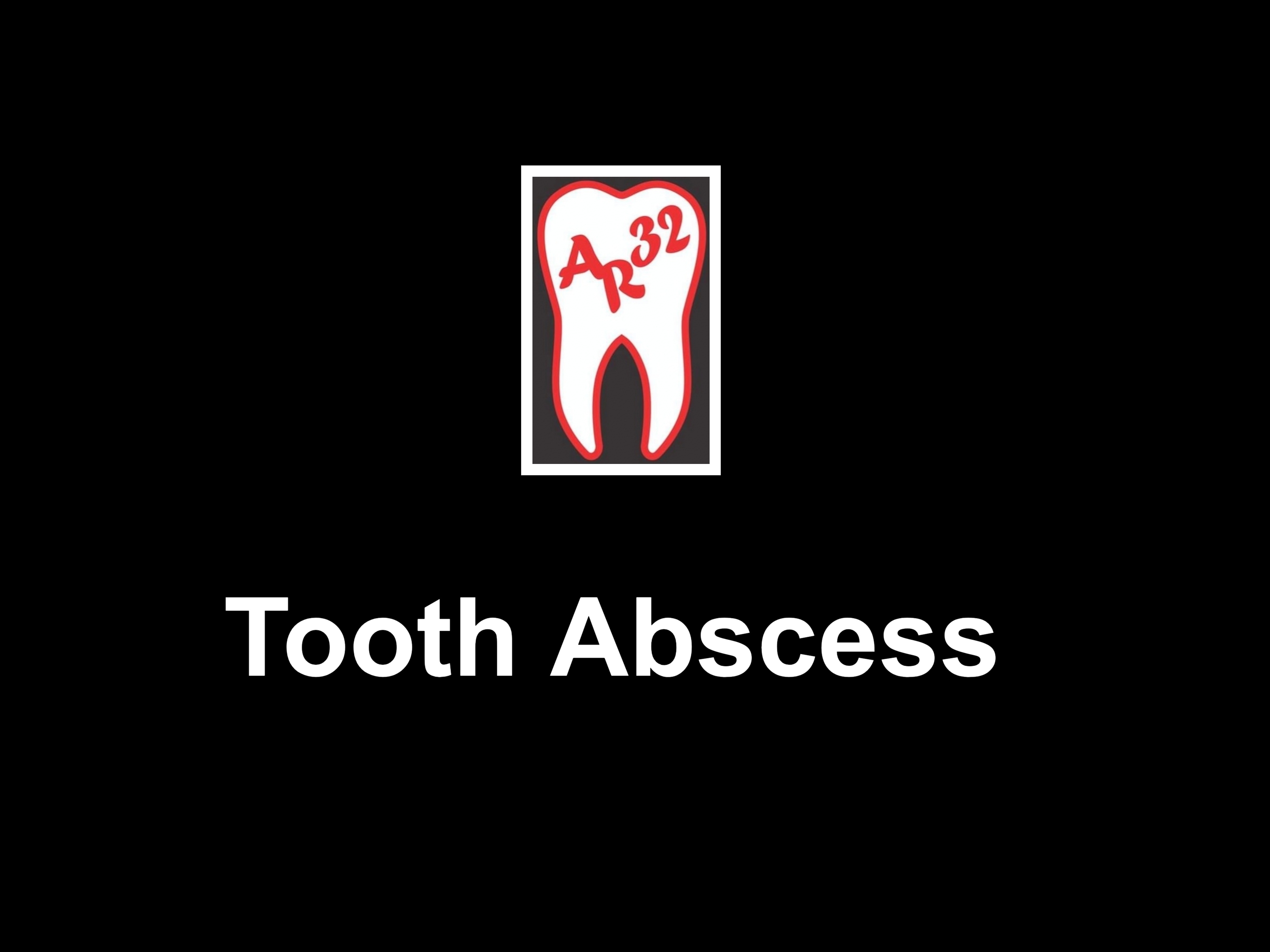Tooth abscess infection and gum swelling representation