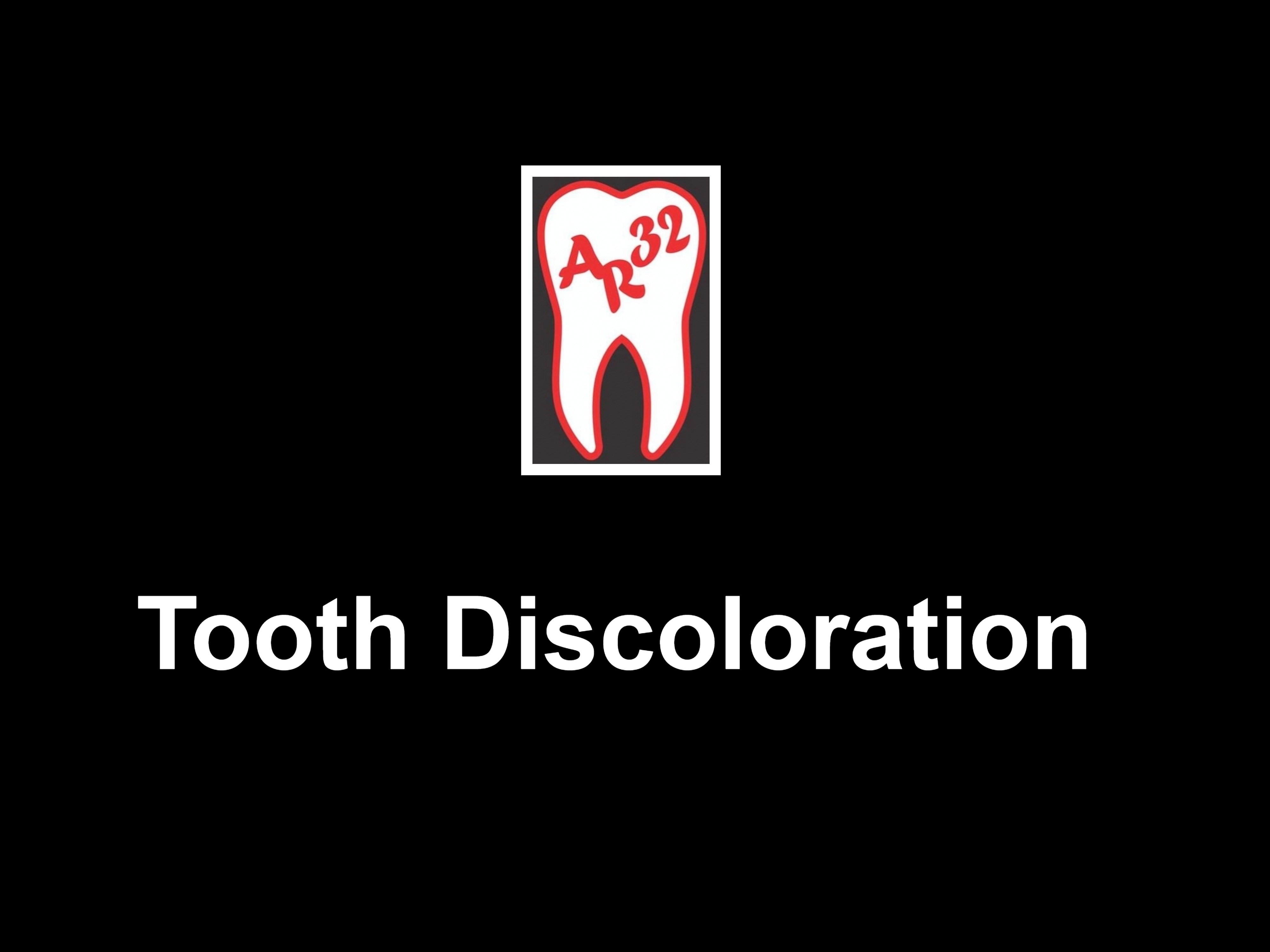 Tooth discoloration yellow stains clinical representation