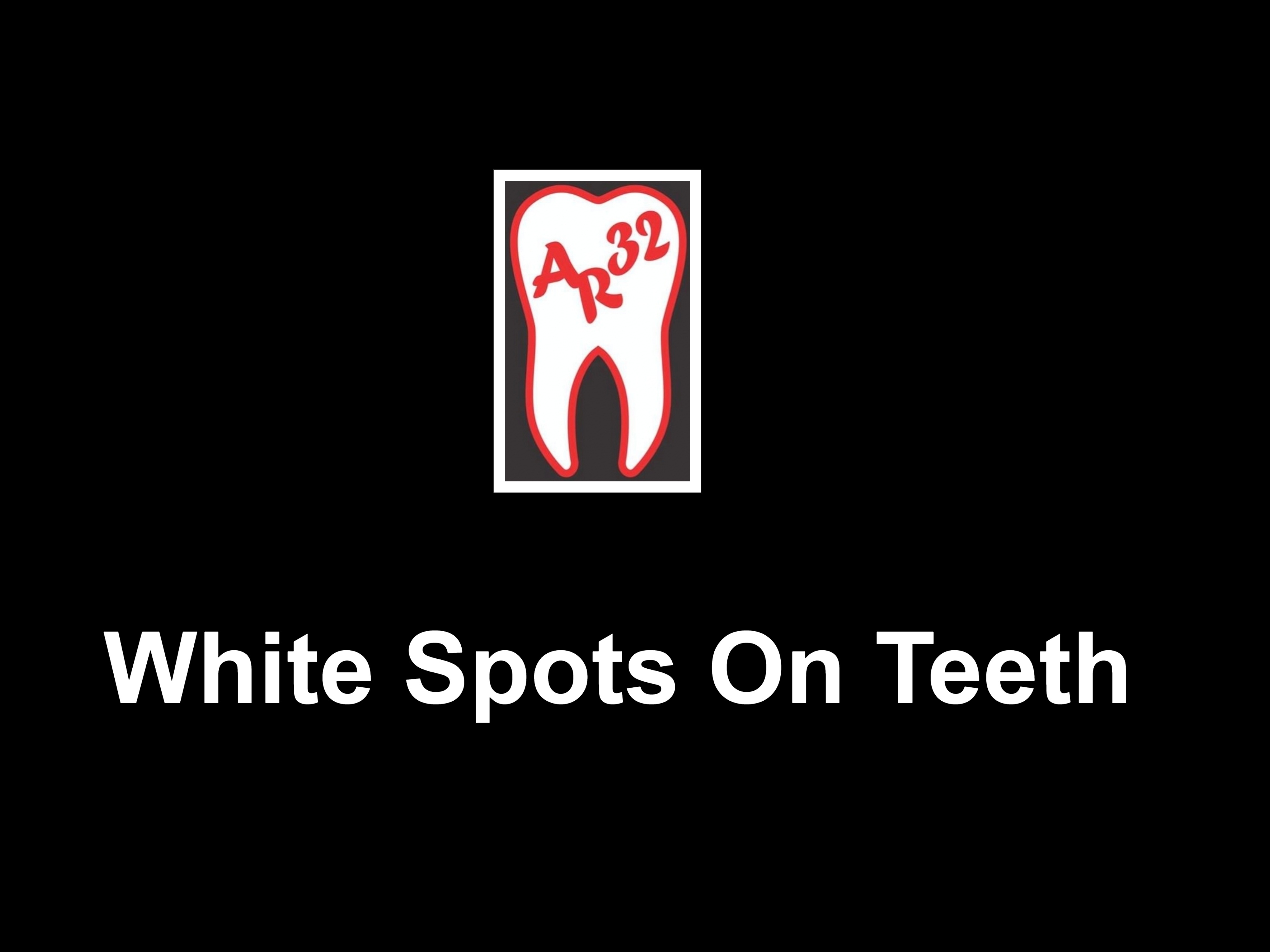 White spots on teeth enamel decalcification fluorosis clinical representation