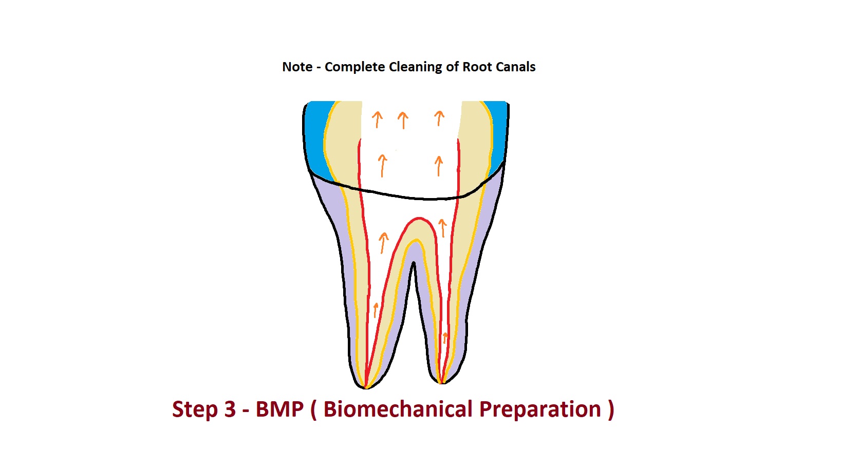 Biomechanical Preparation